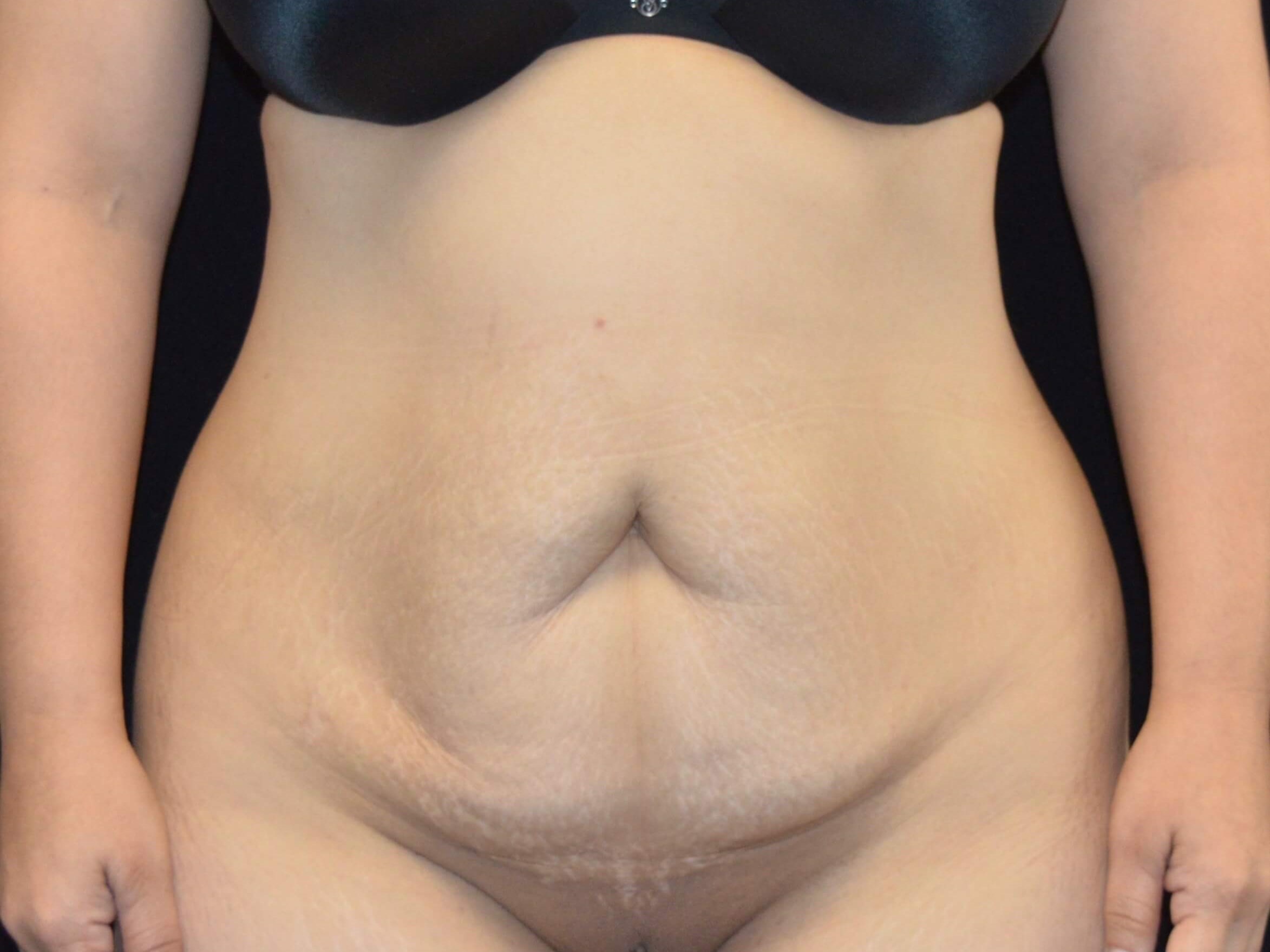 Before Image