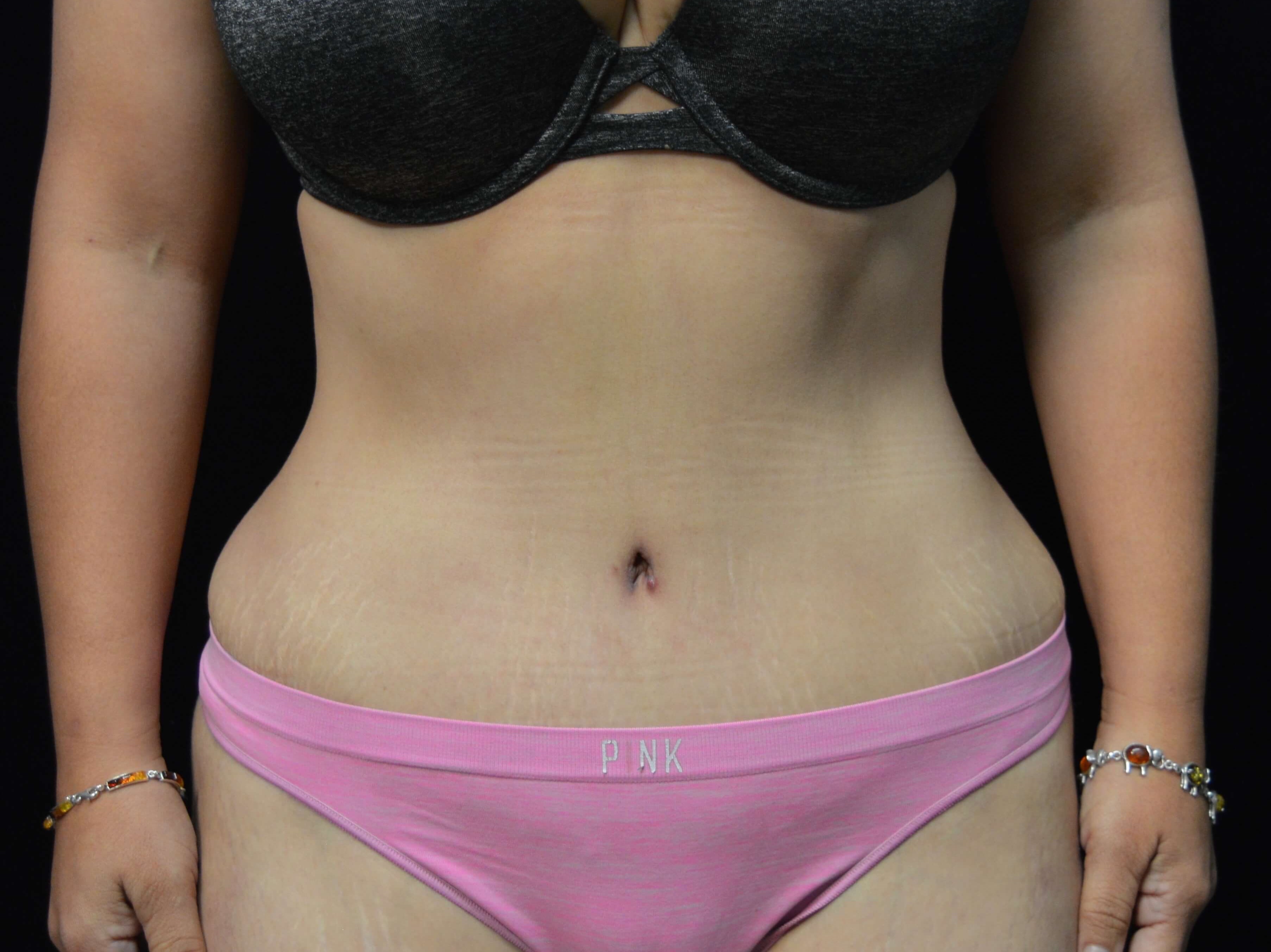 After Image