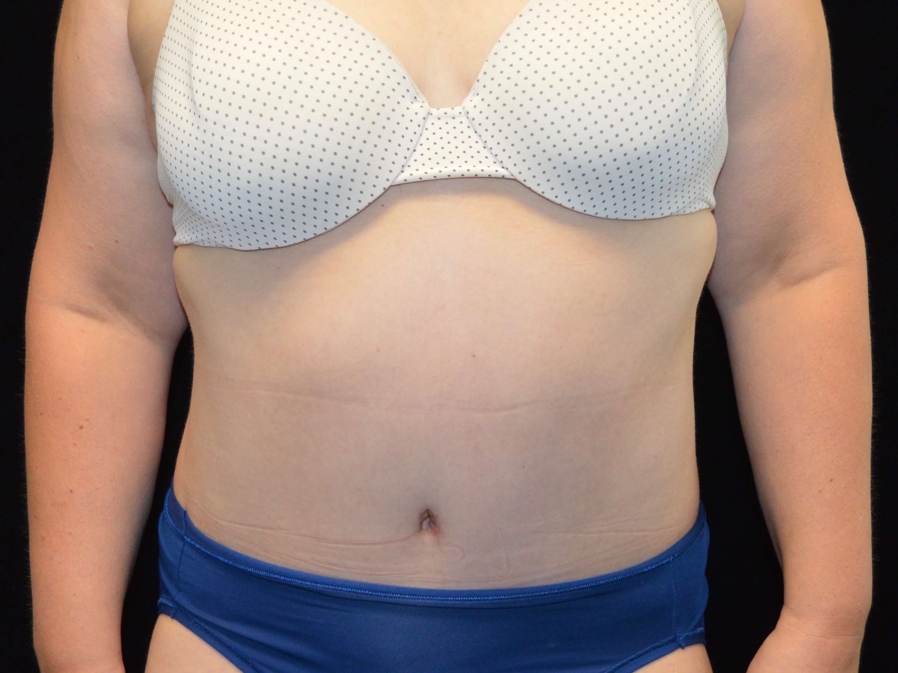 After Image