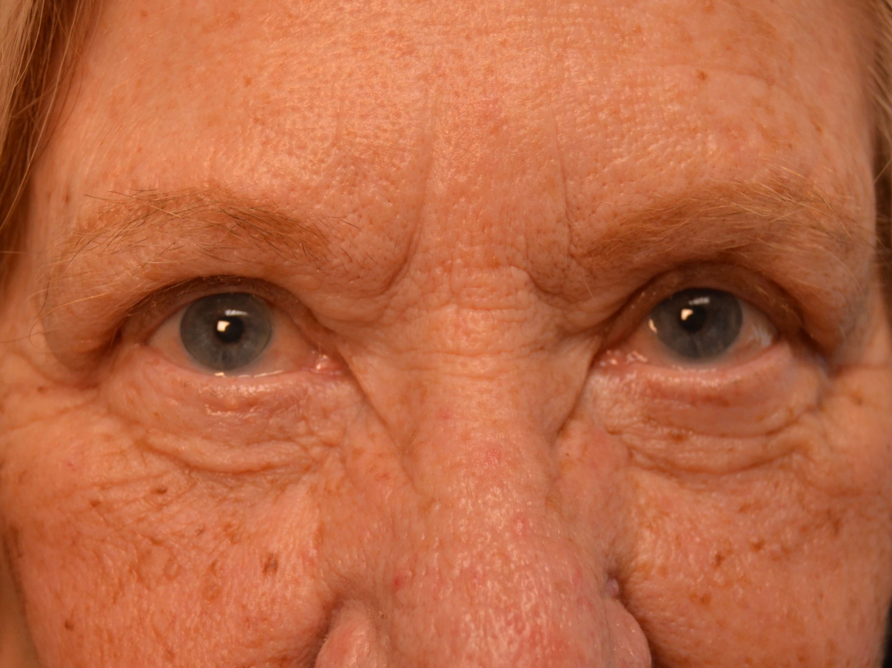 After Image