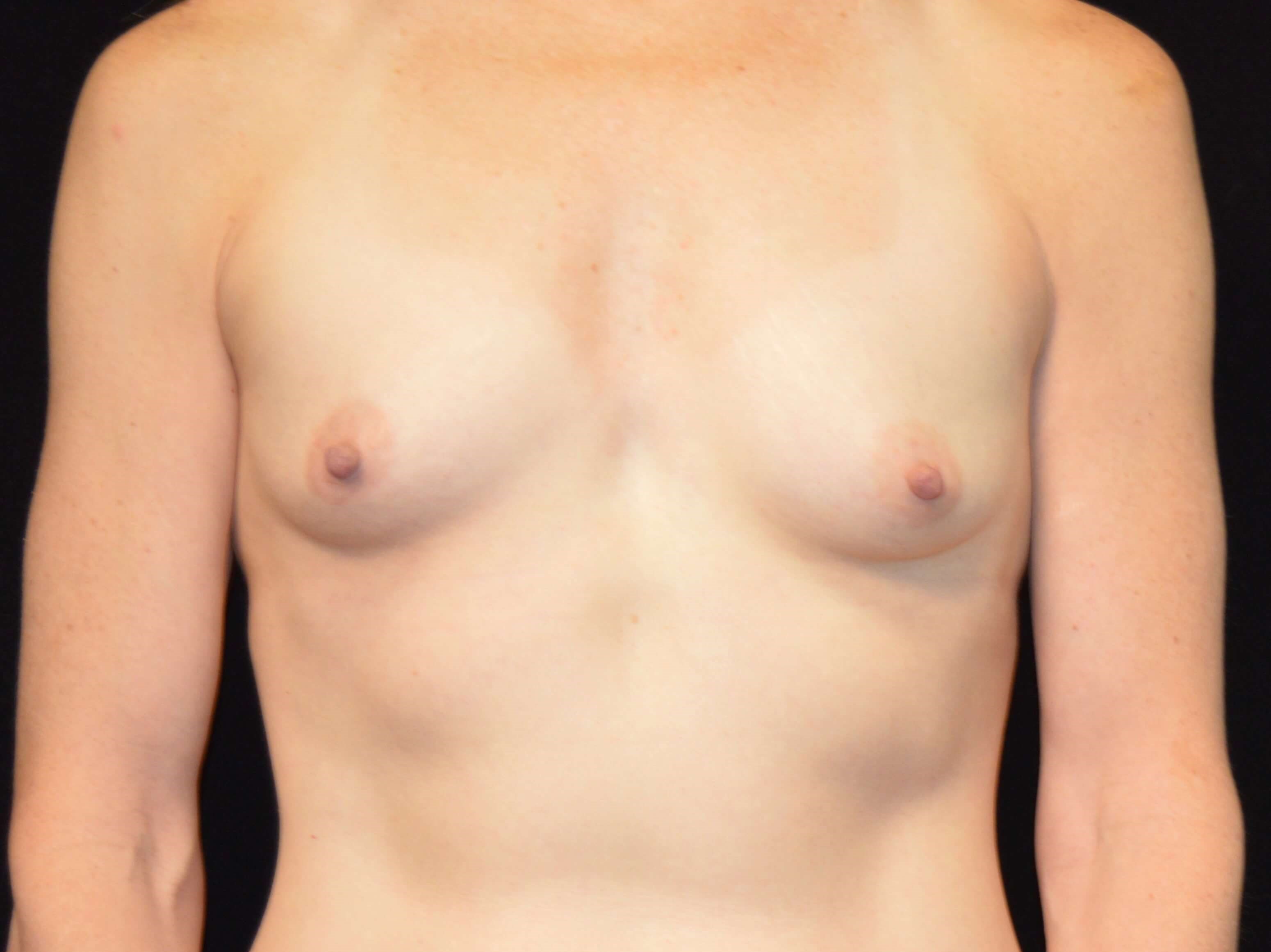 Before and After Before