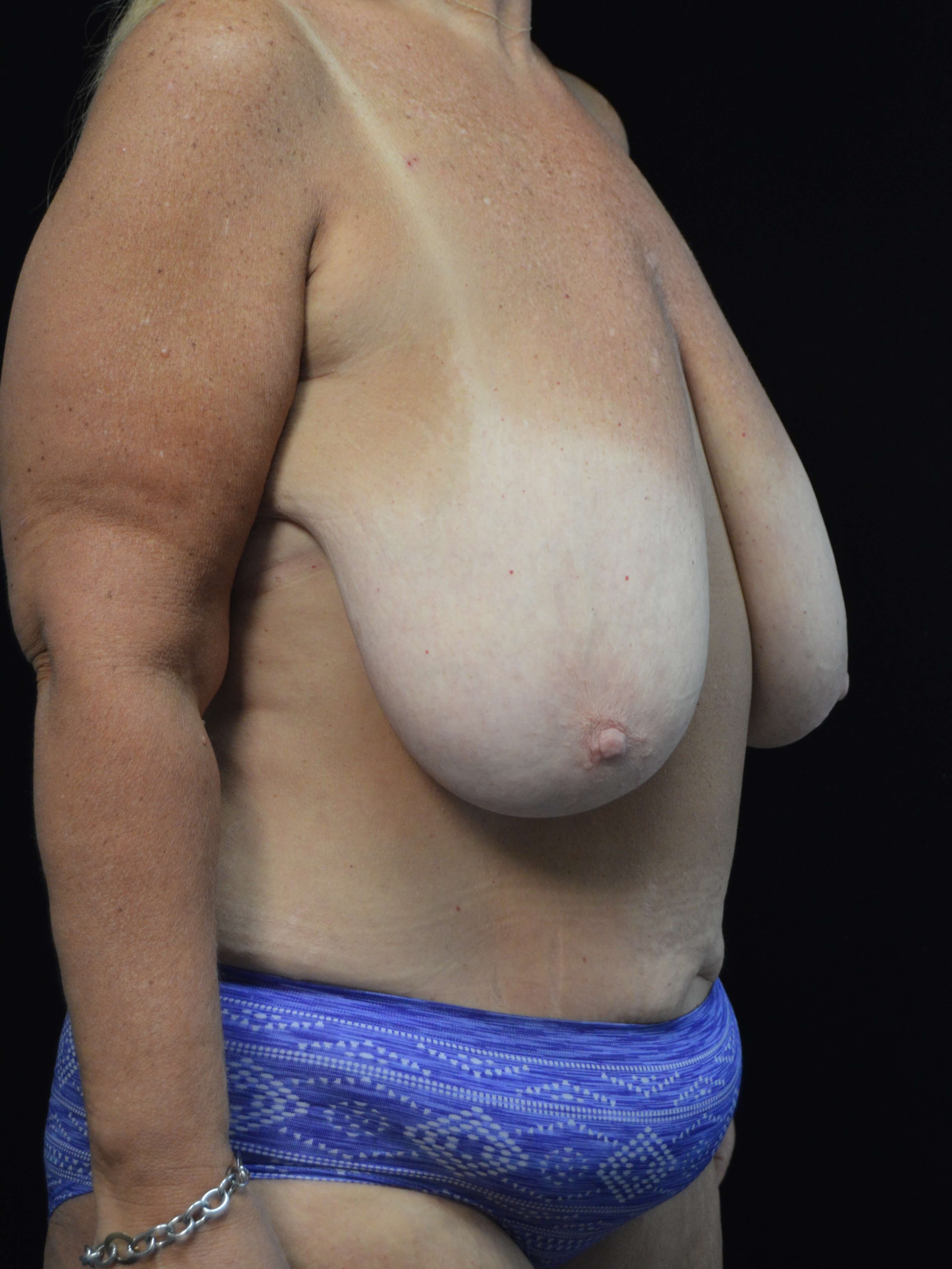 Before and After Before