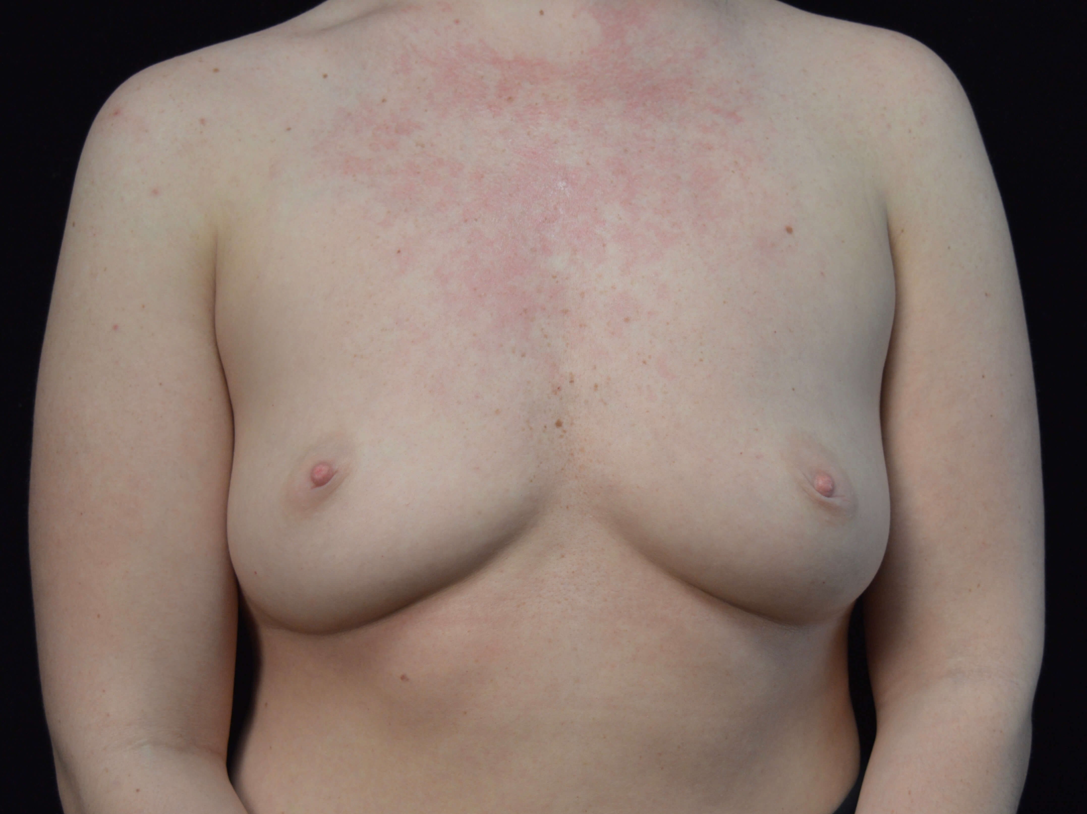 Before and After Before