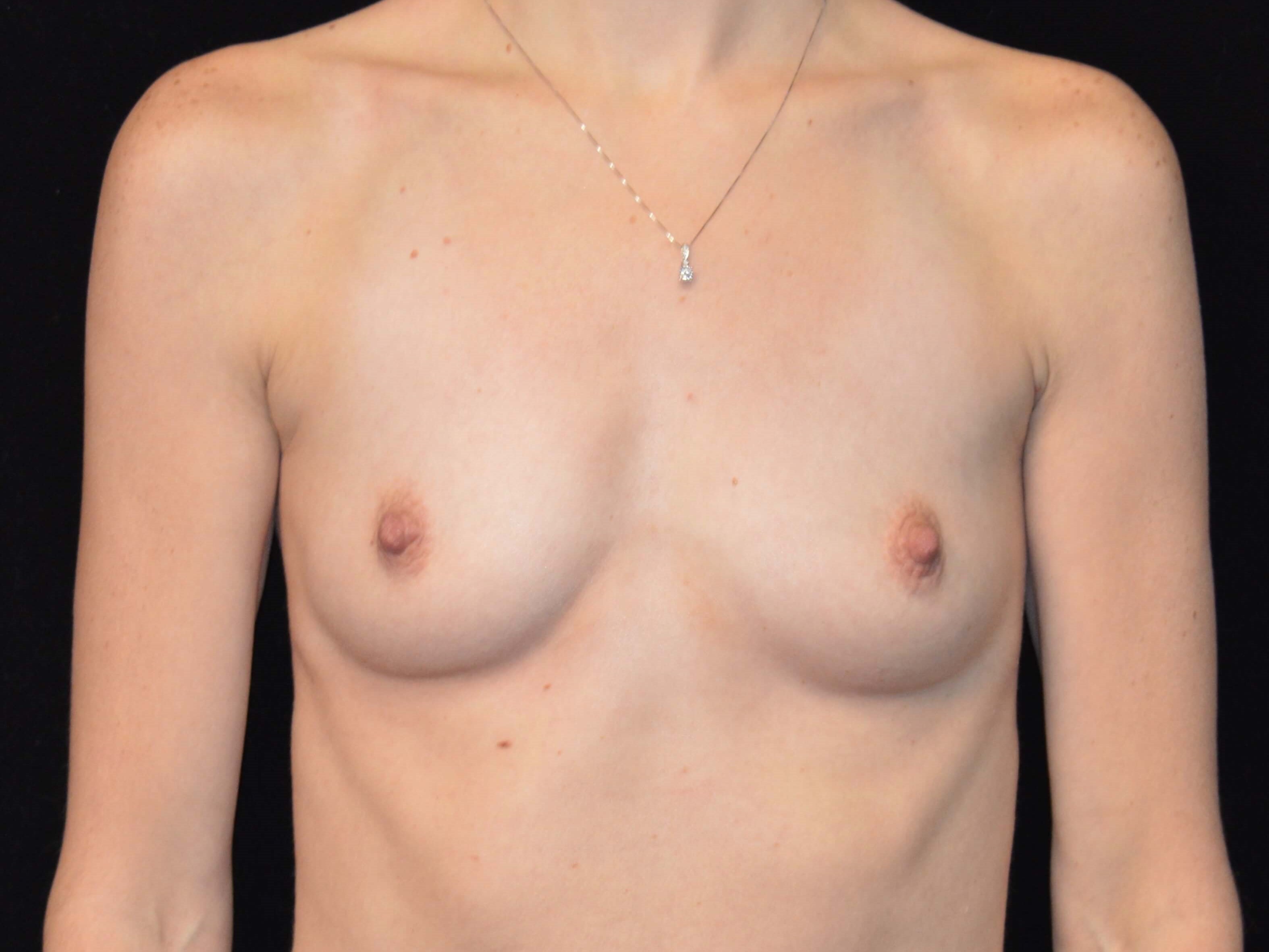 Before and After Before