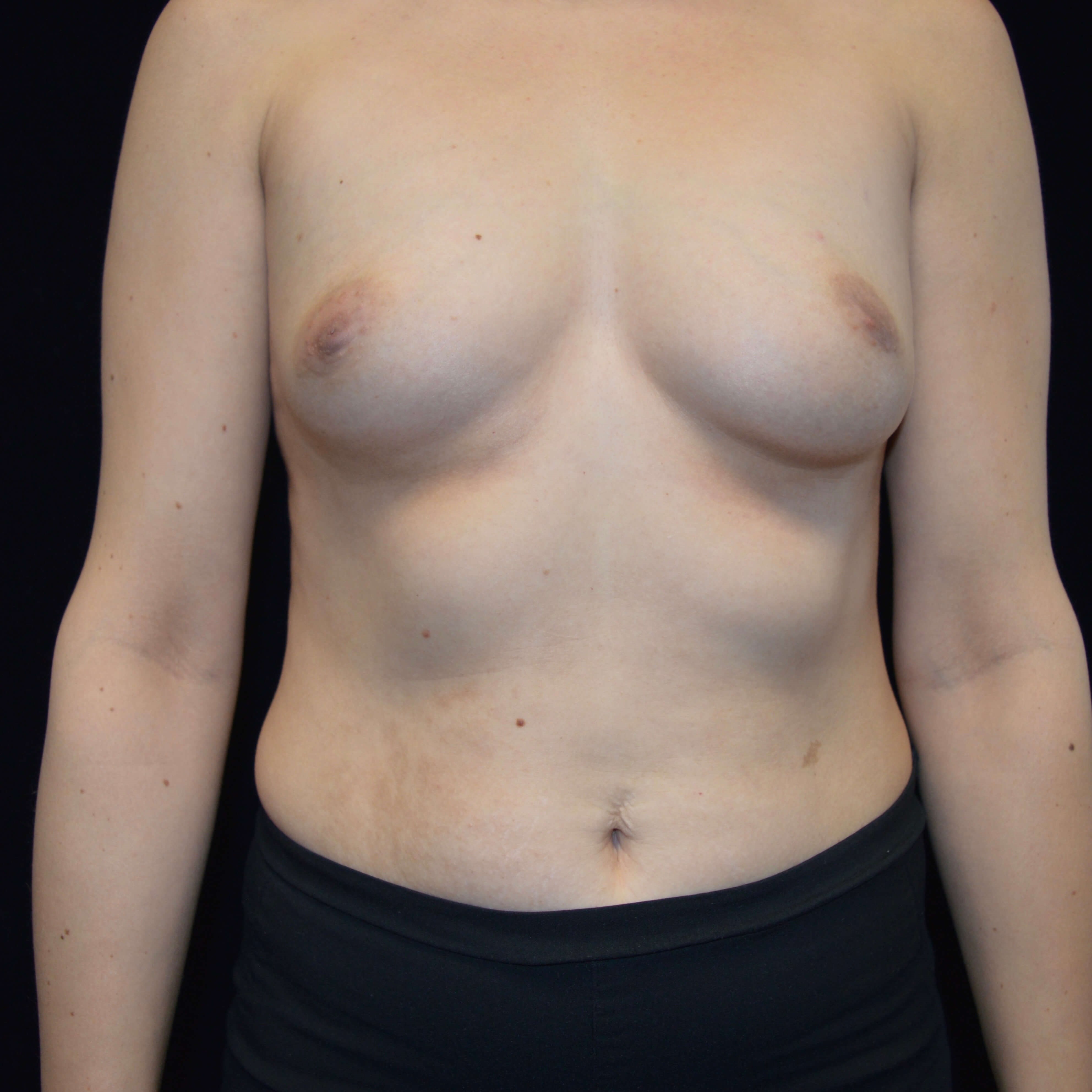 Before and After Before