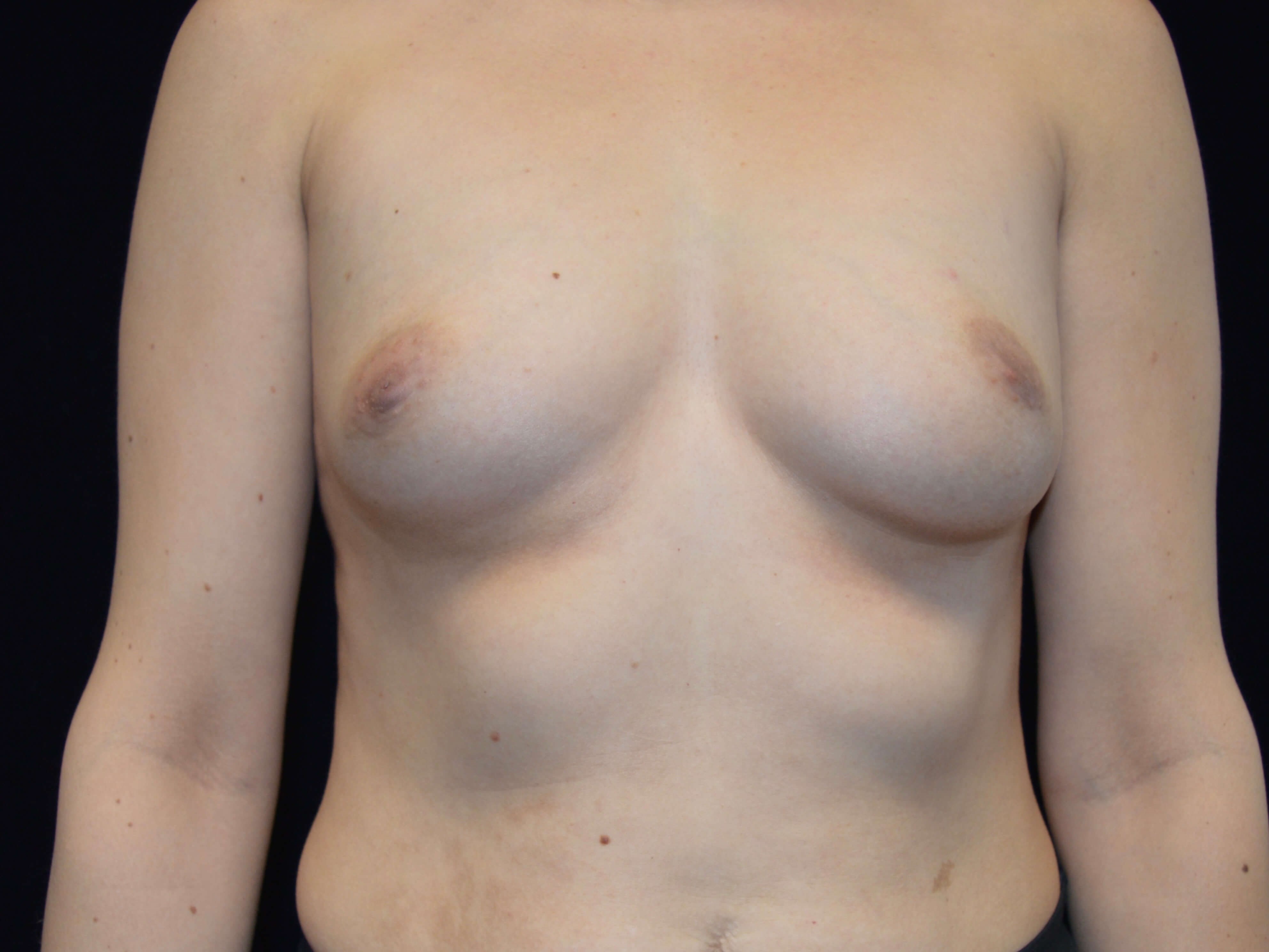 Before and After Before