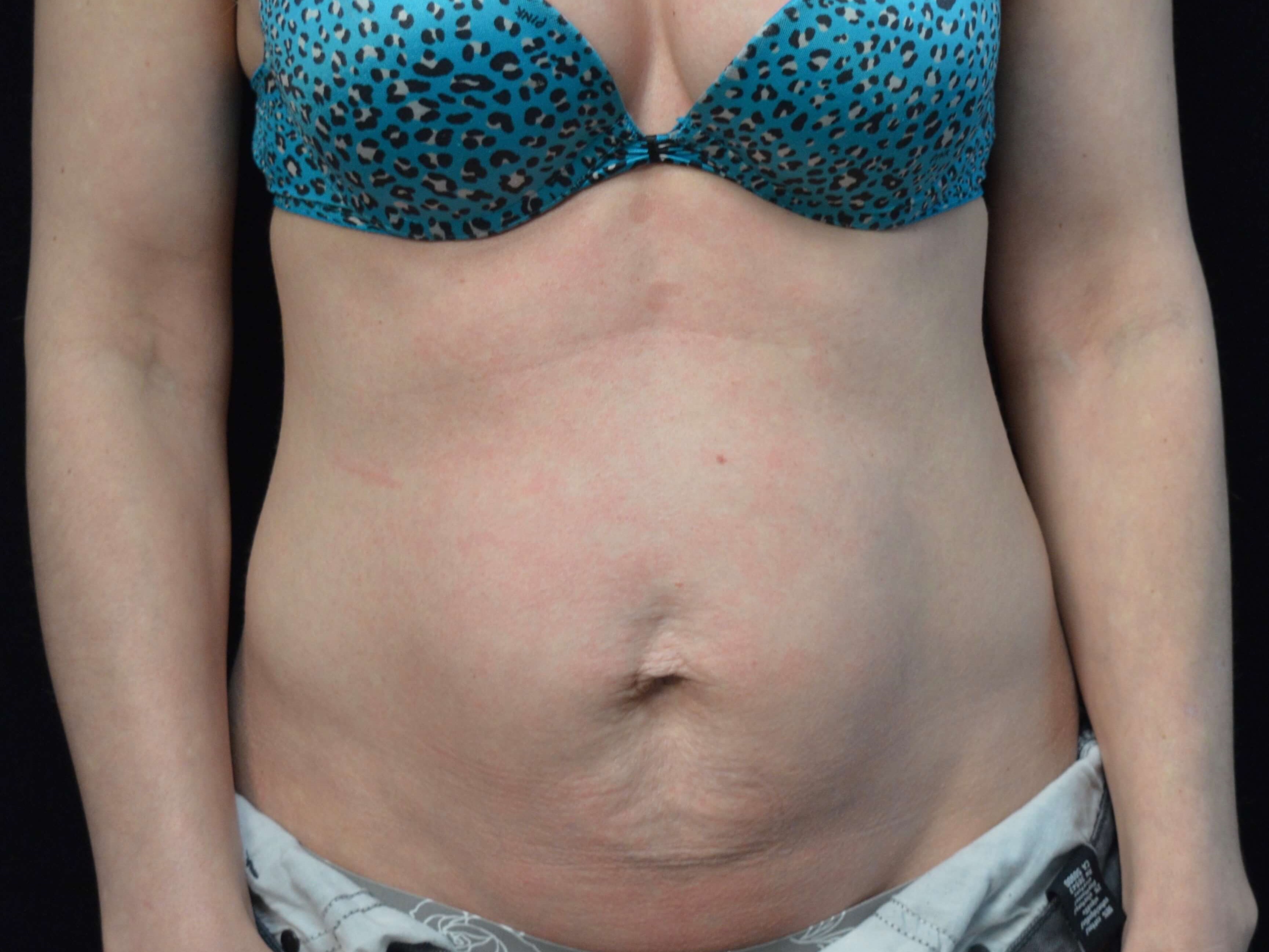 Before and After Before