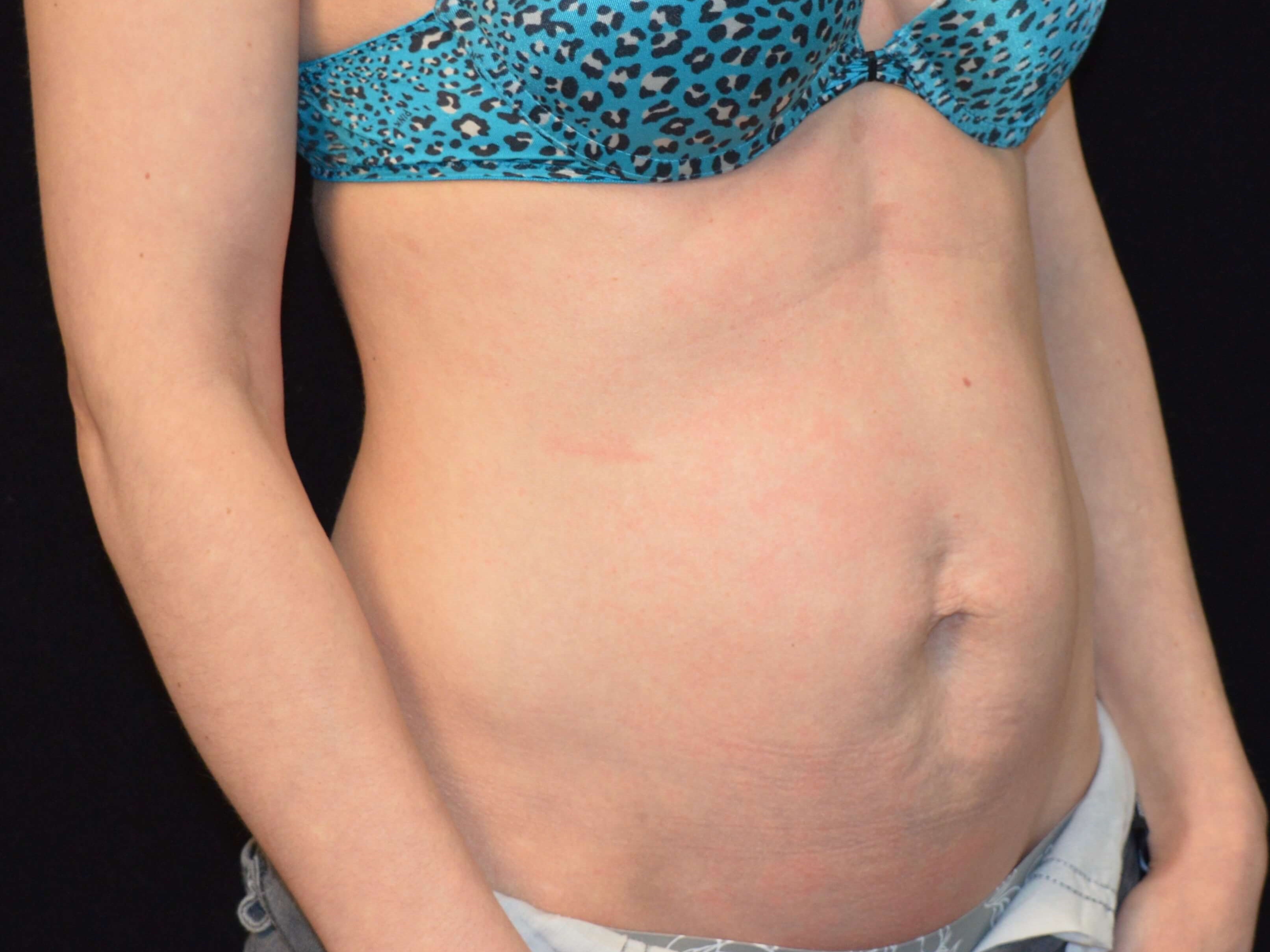 Before and After Before