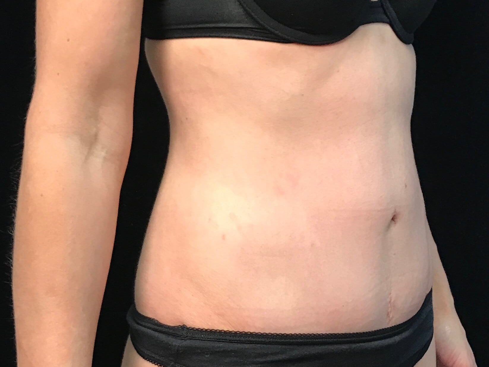 Before and After After