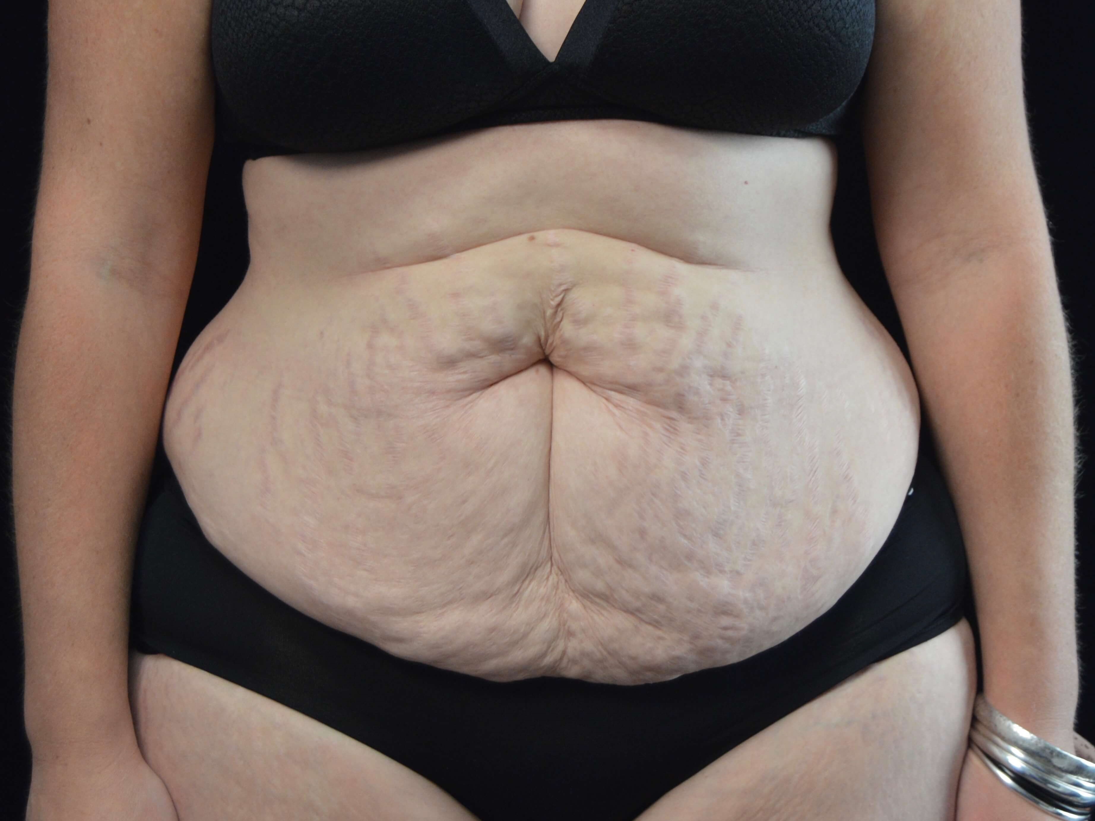 Before and After Before