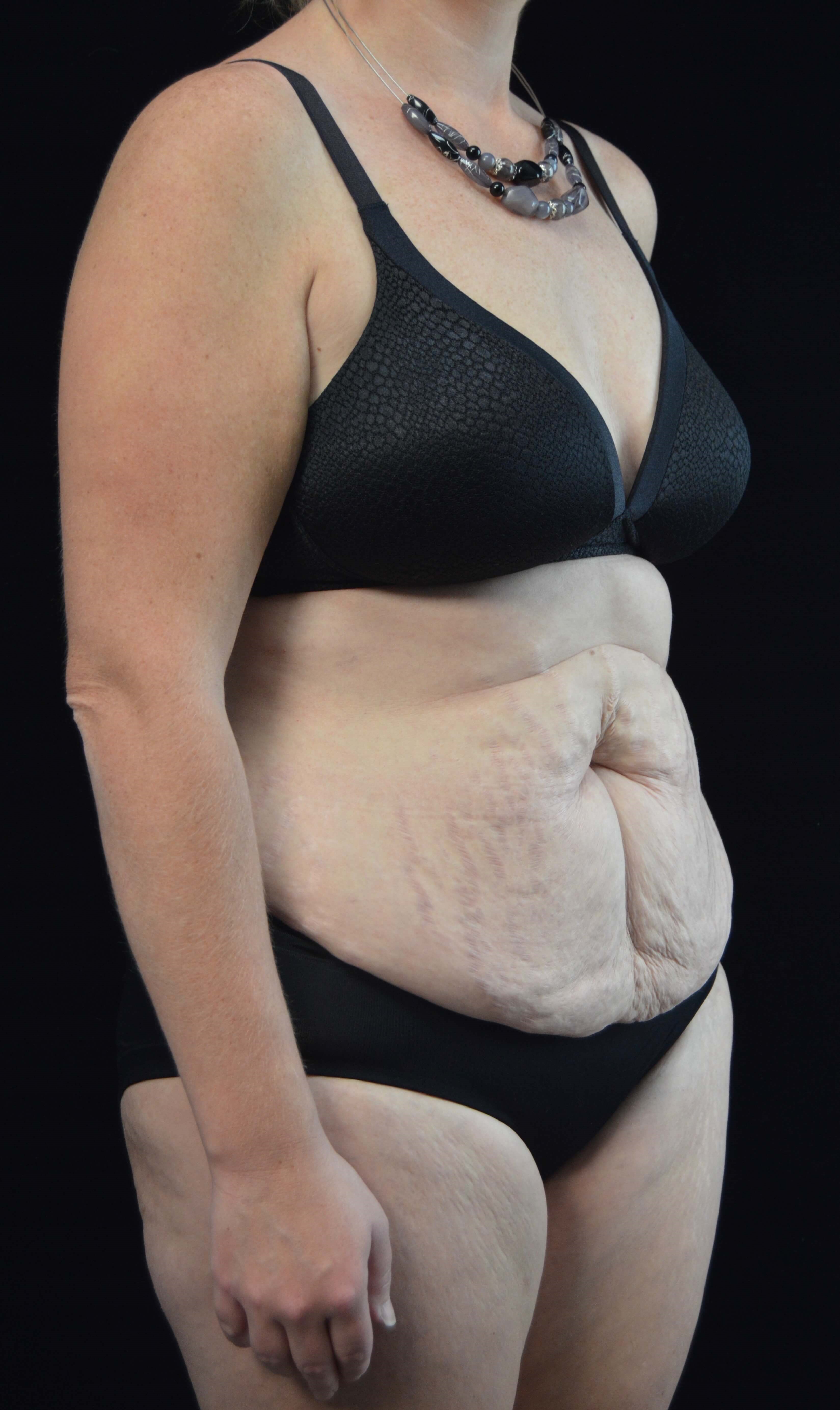 Before and After Before