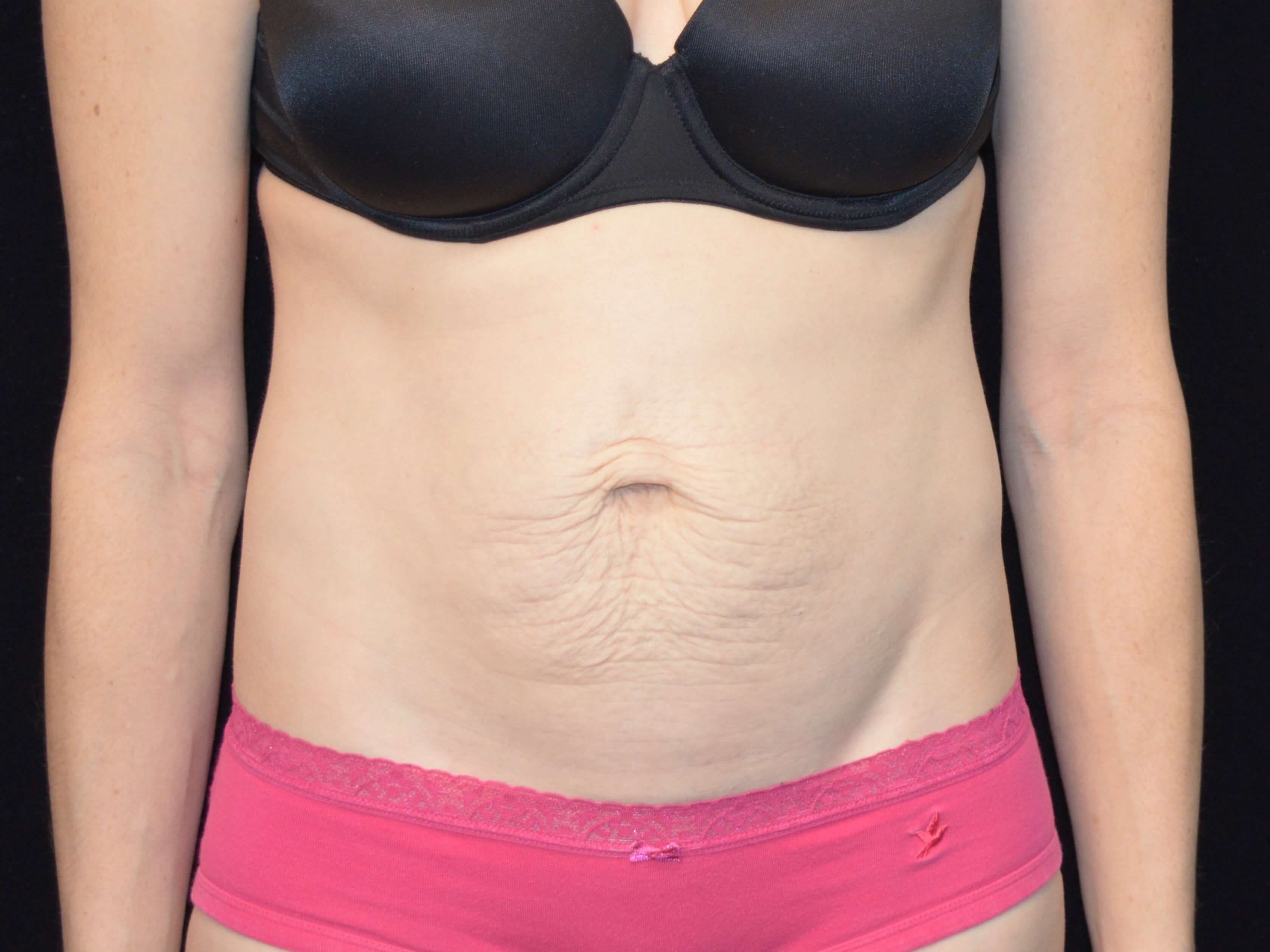 Before and After Before