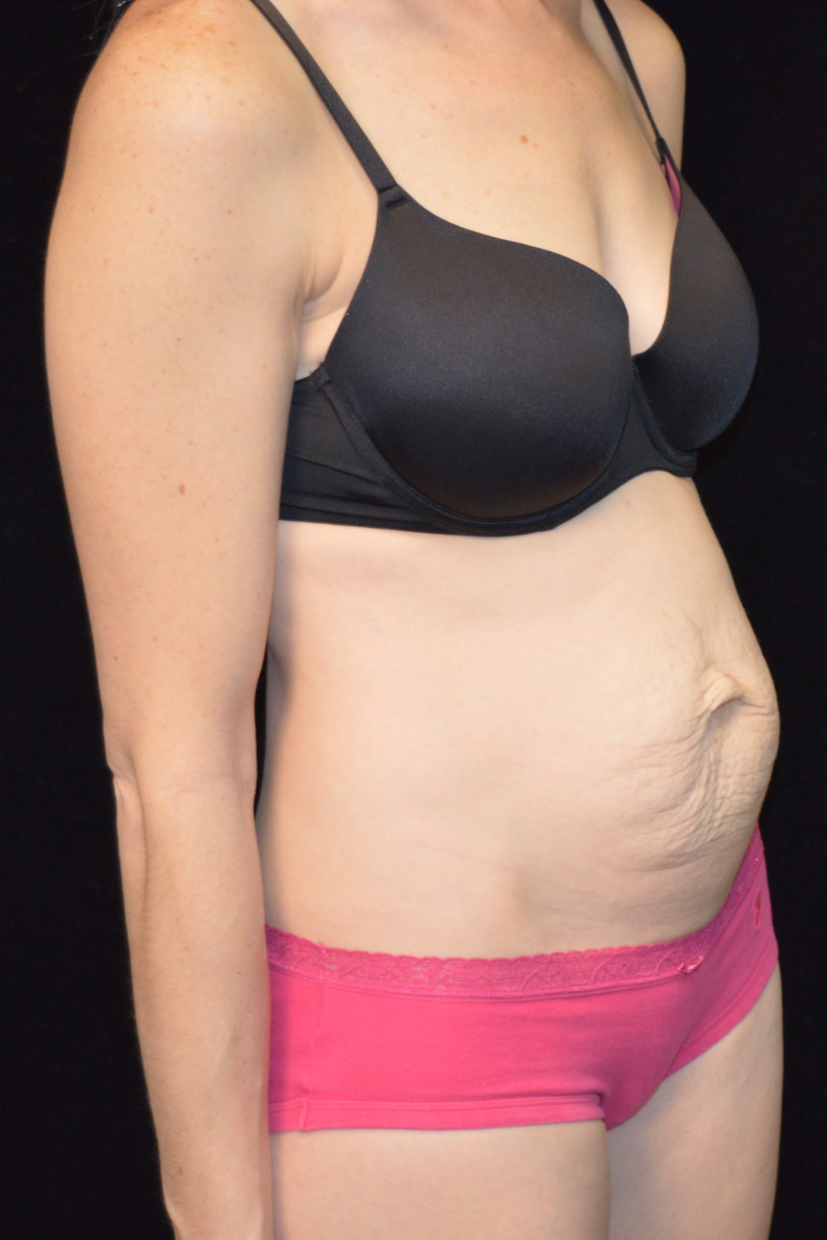 Before and After Before