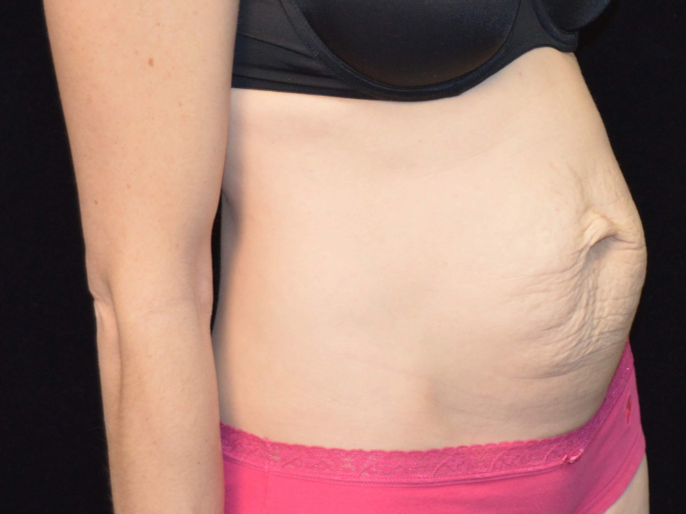 Before and After Before