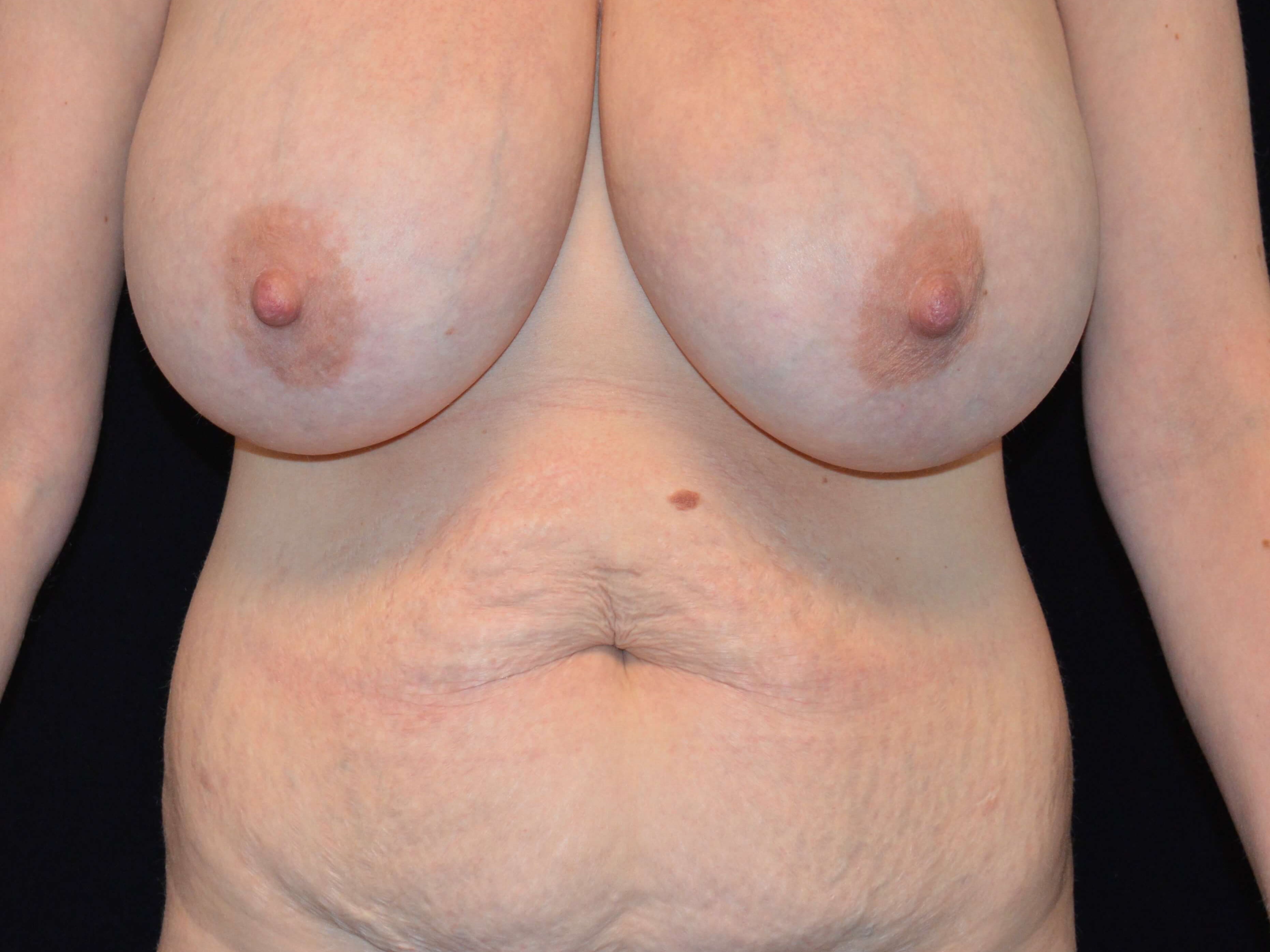 Before and After Before