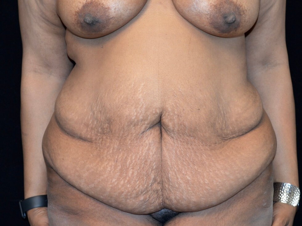 Before and After Before