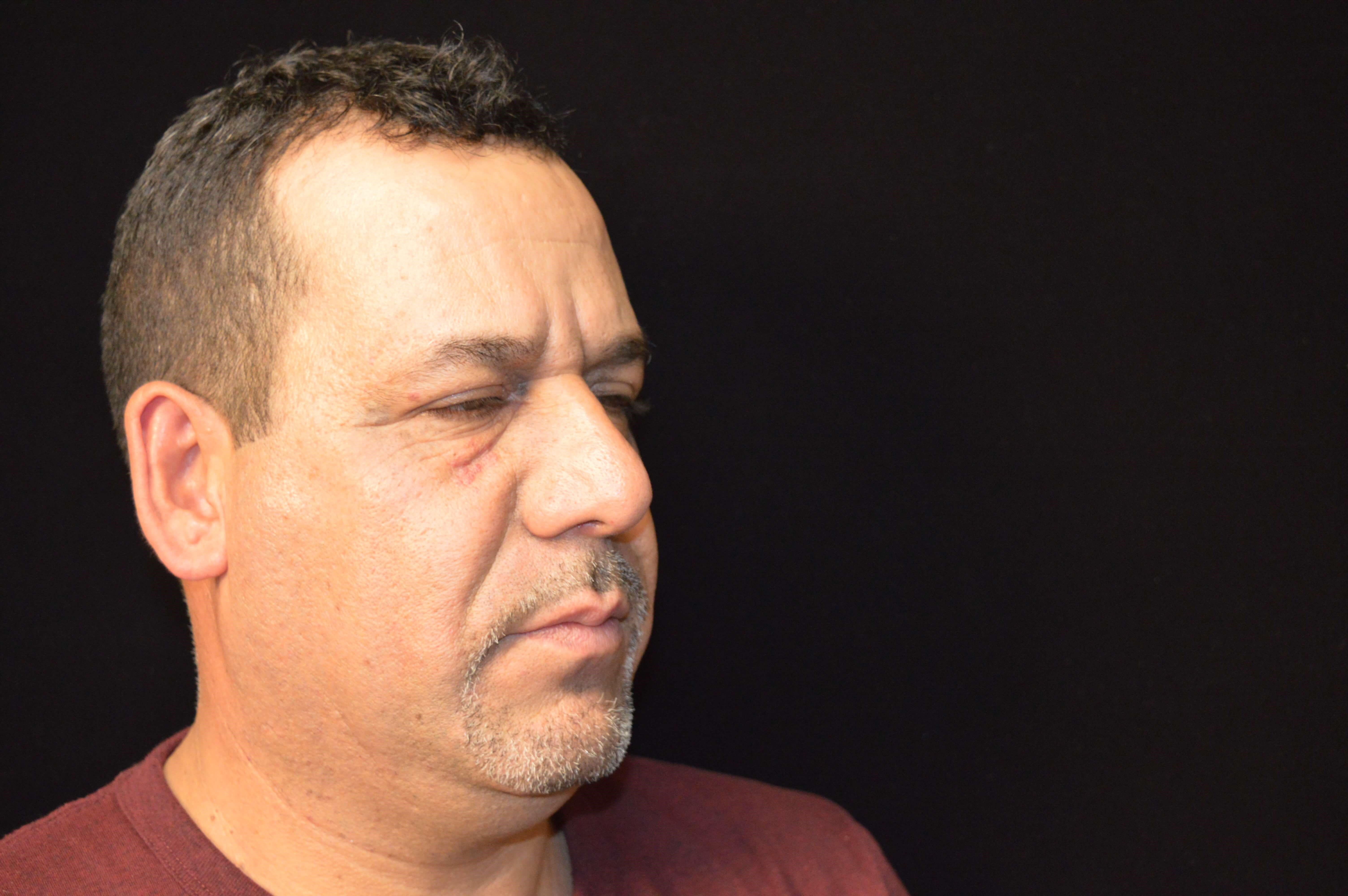 Before and After Before