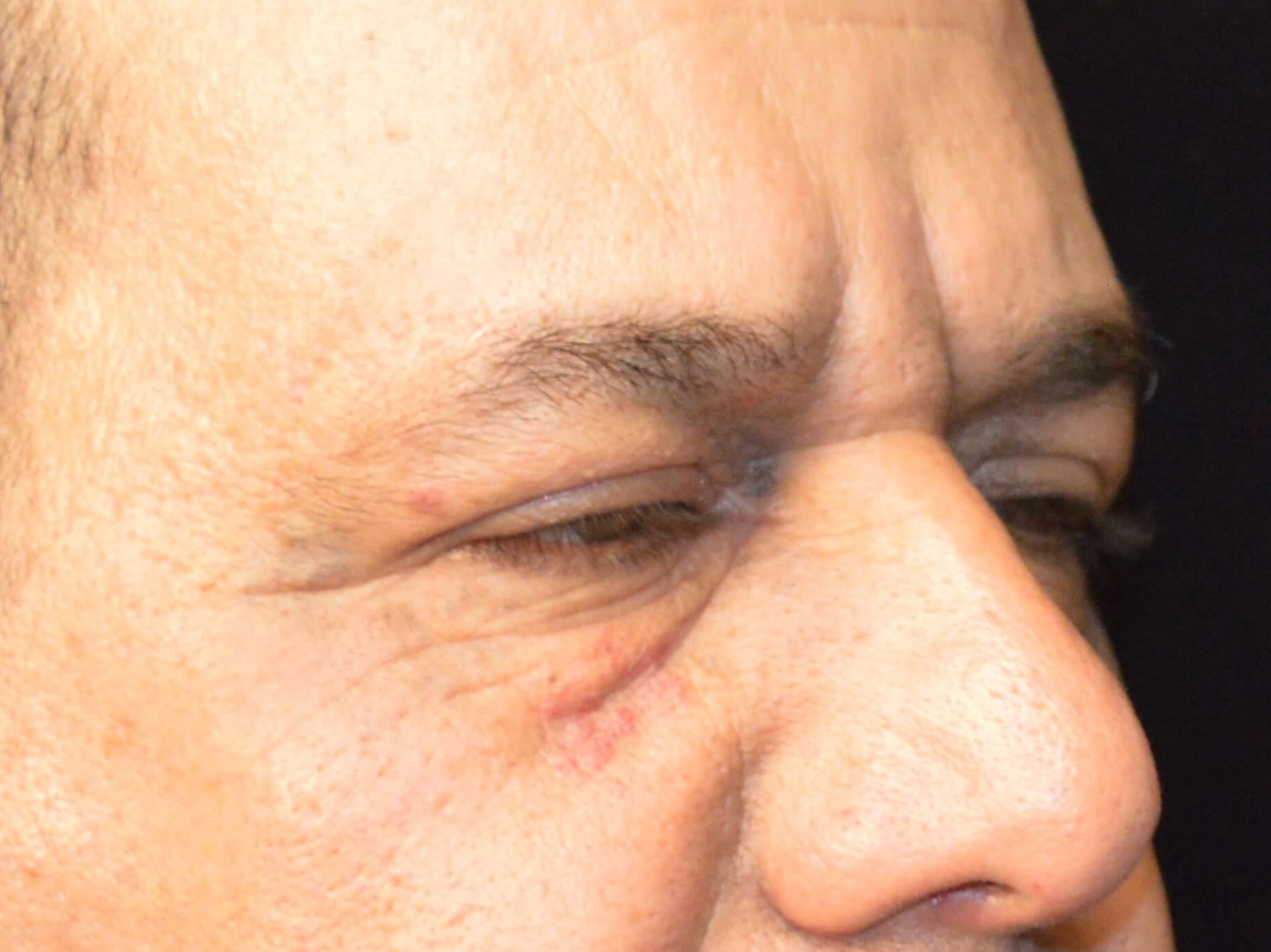 Before and After Before