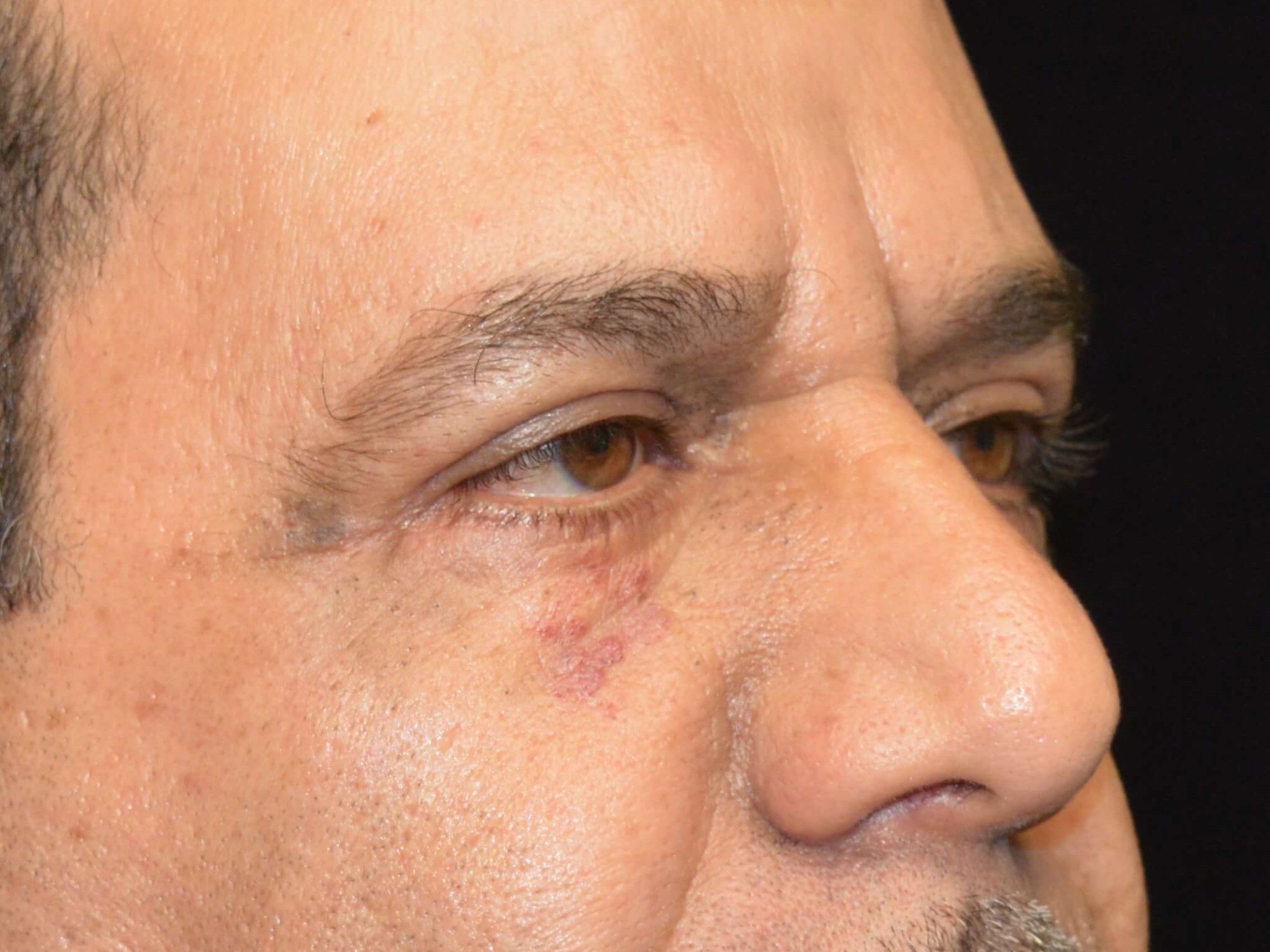 Before and After After