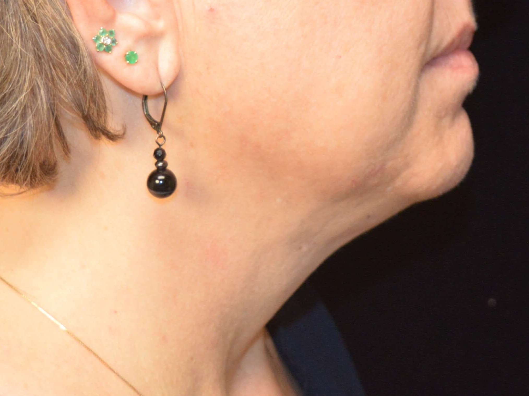 Before and After Before