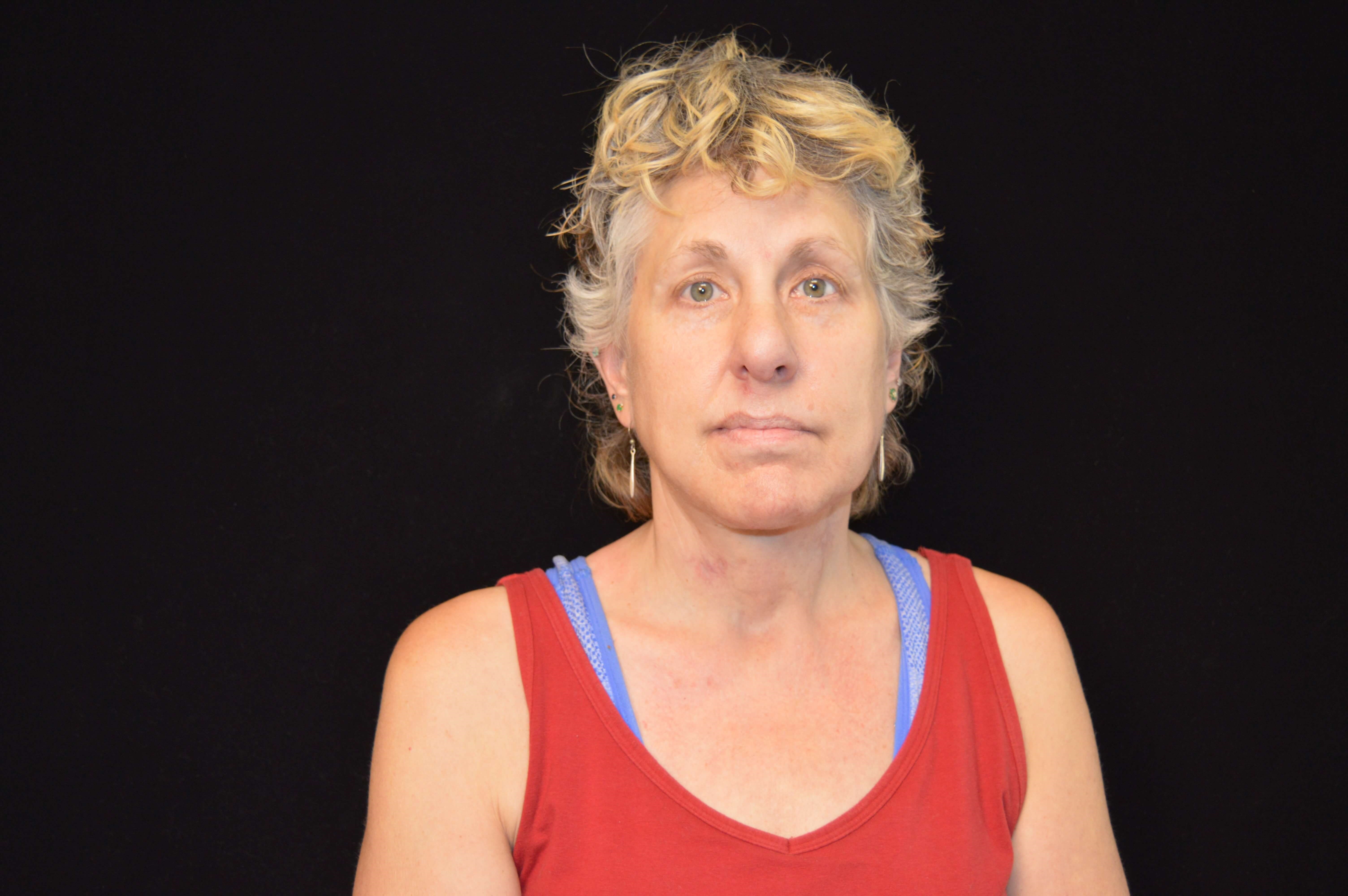 Before and After After