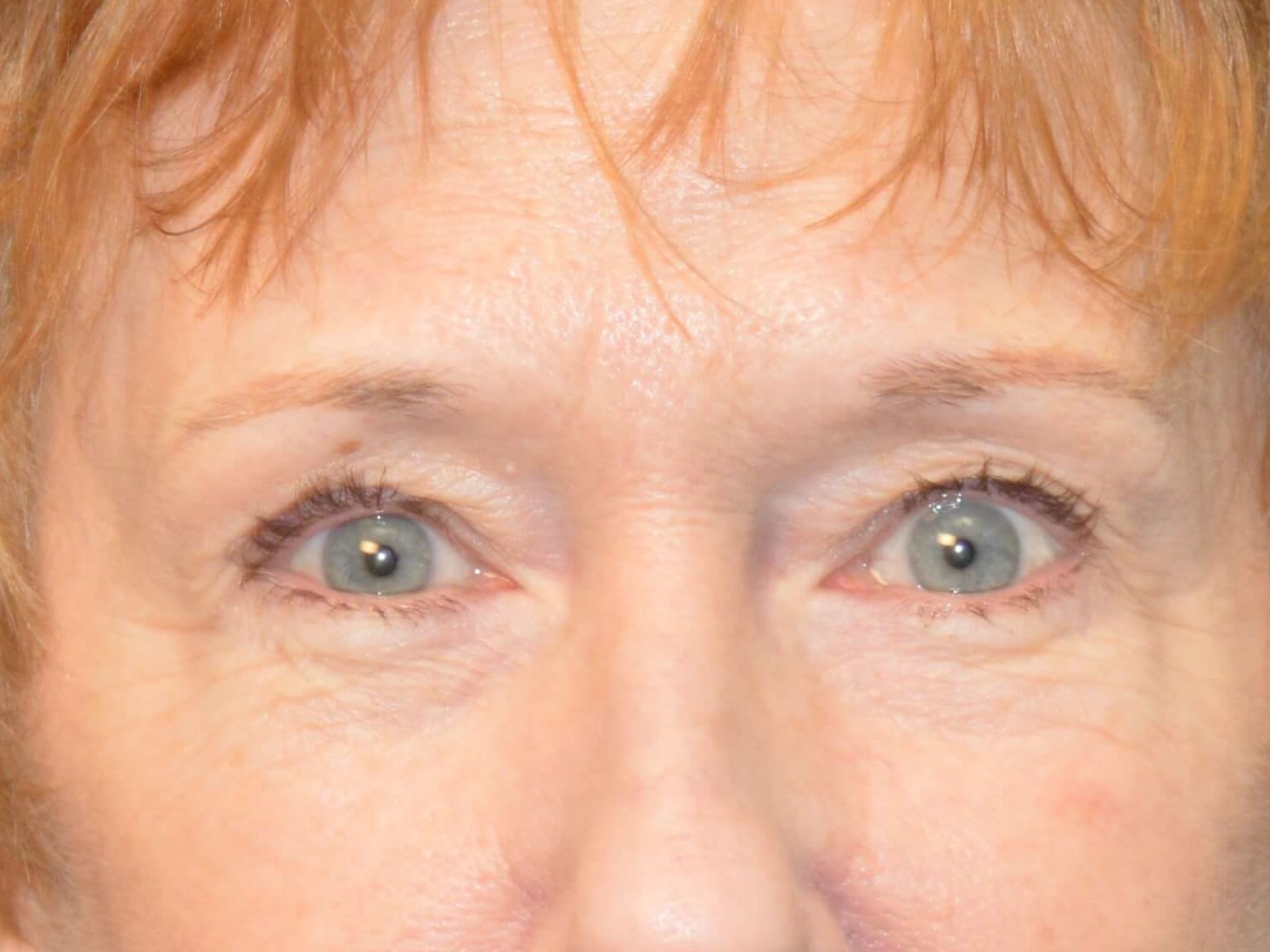 Before and After Before