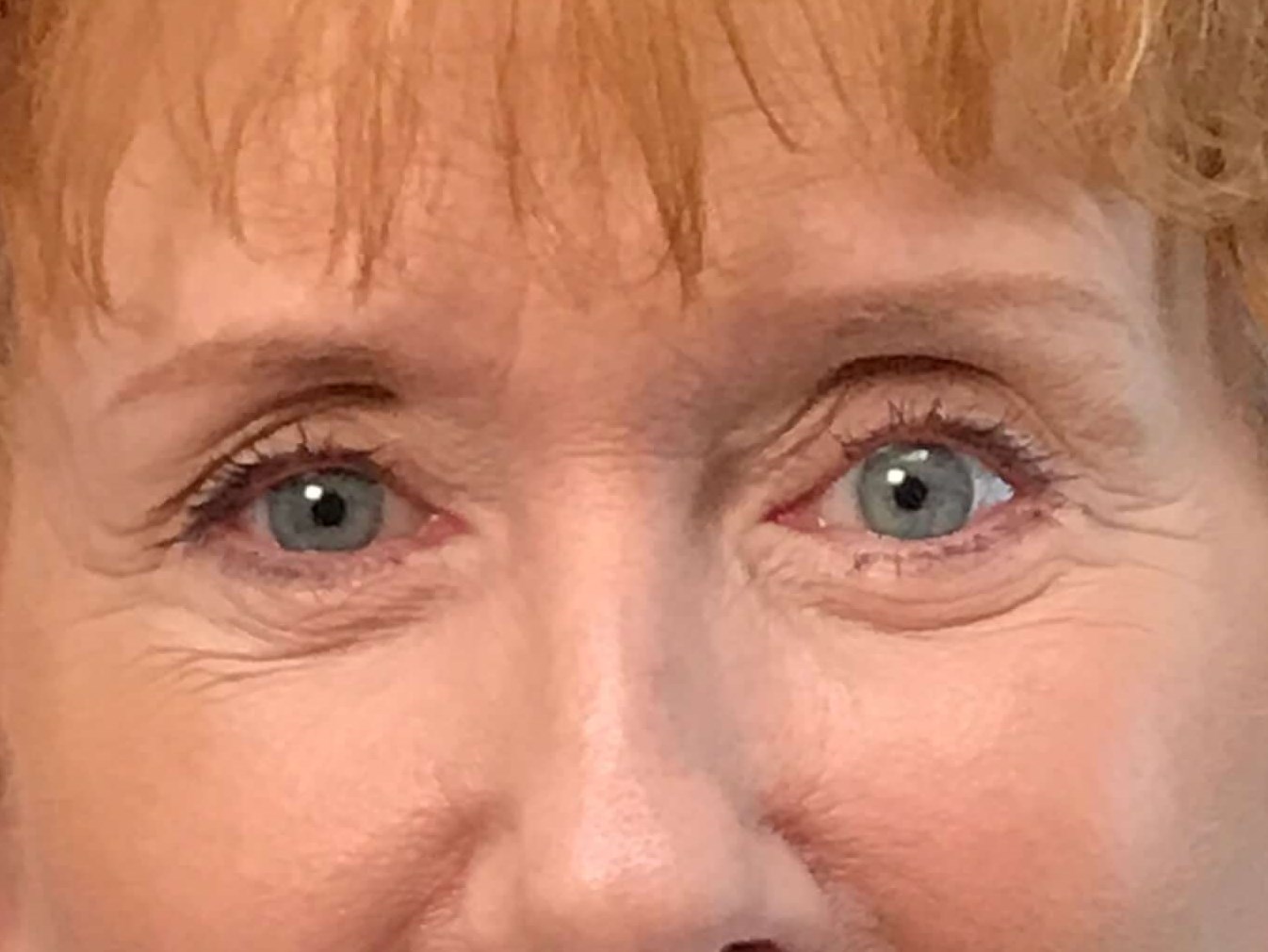 Before and After After