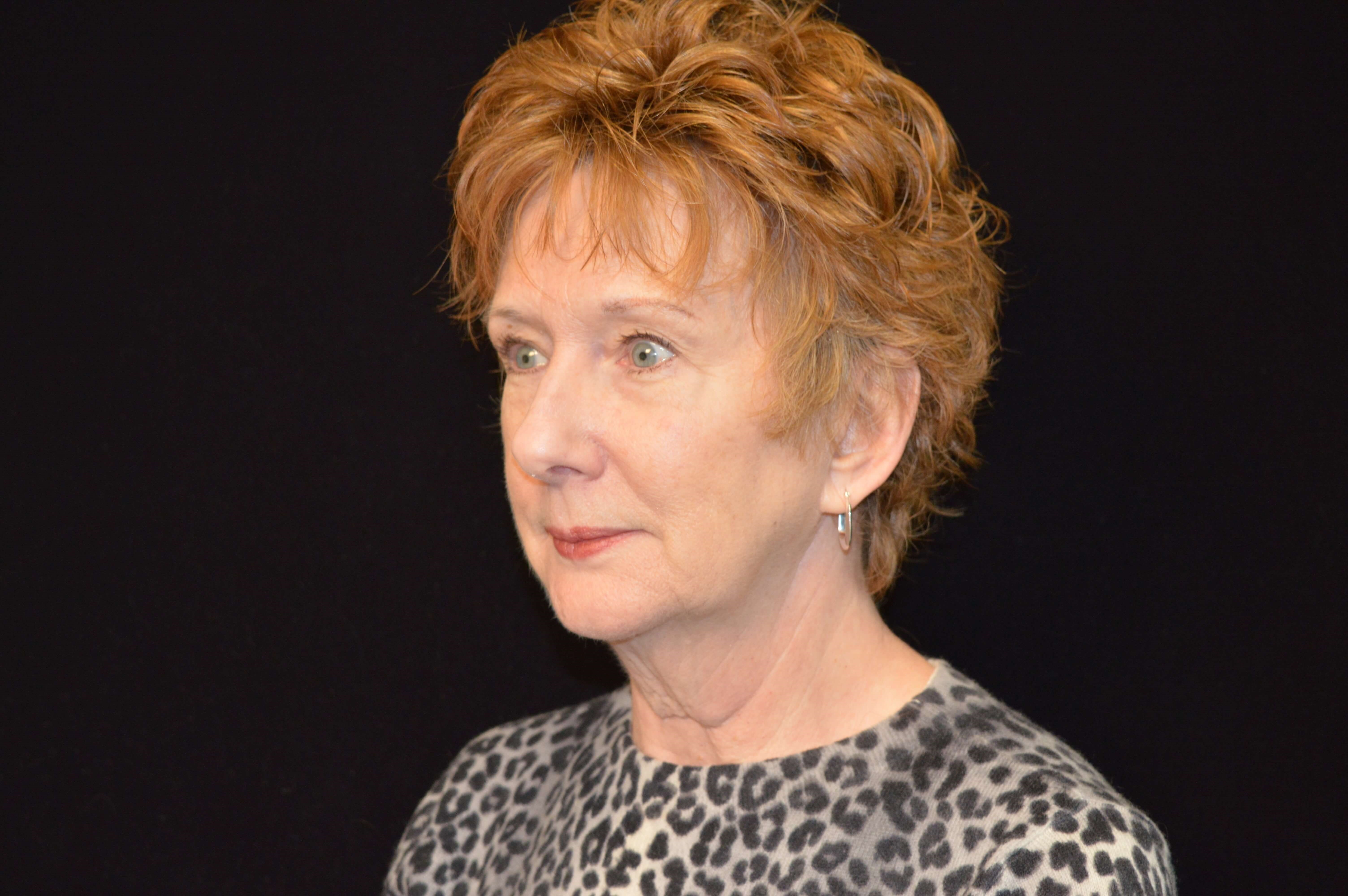 Before and After Before