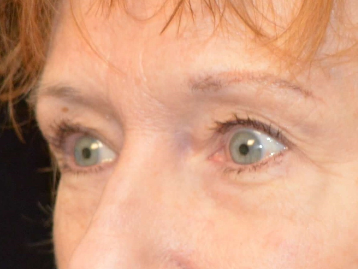 Before and After Before