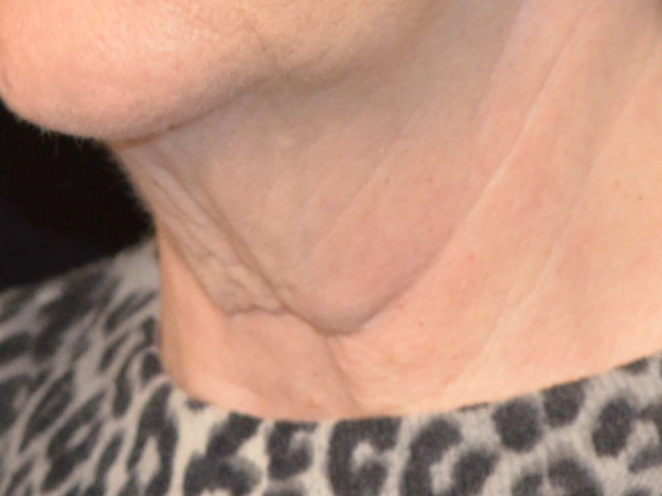 Before and After Before