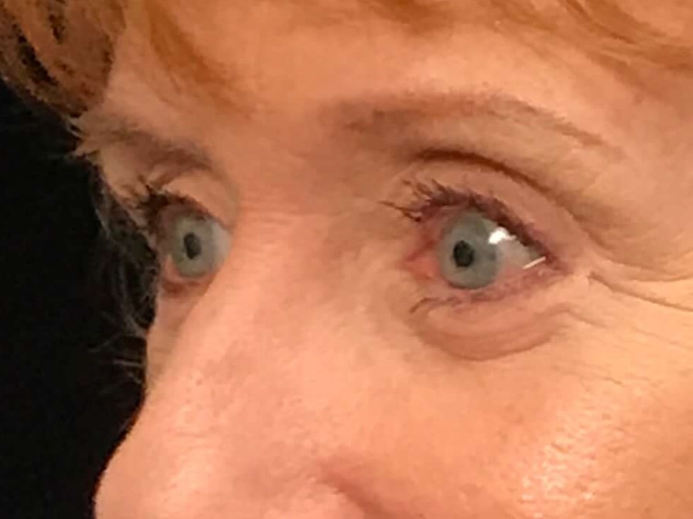 Before and After After