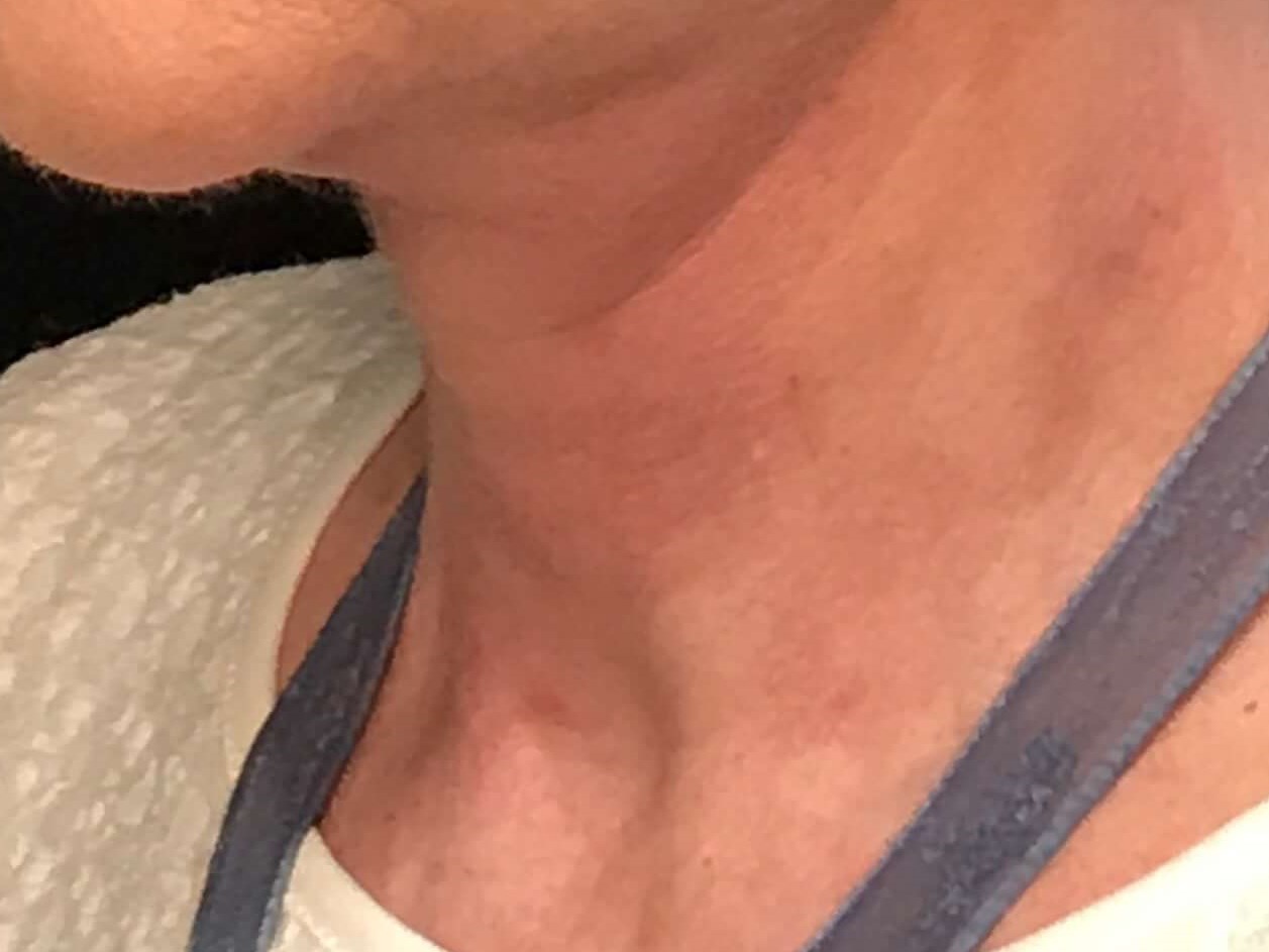 Before and After After