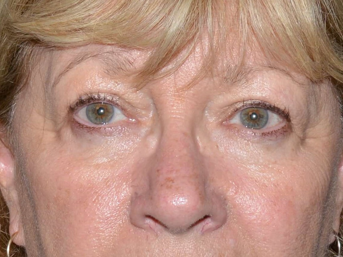 Before and After Before