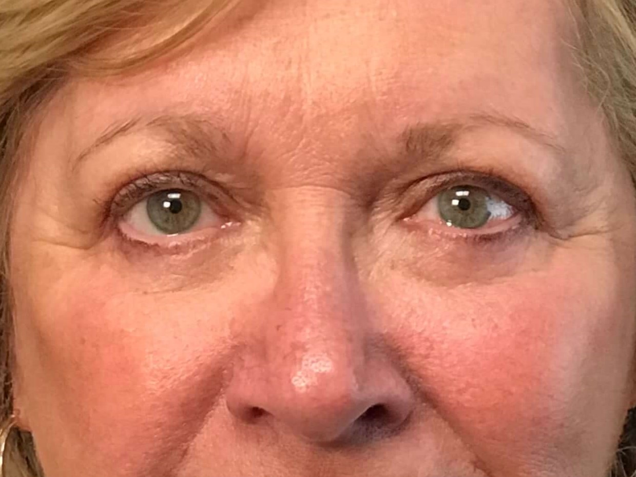 Before and After After