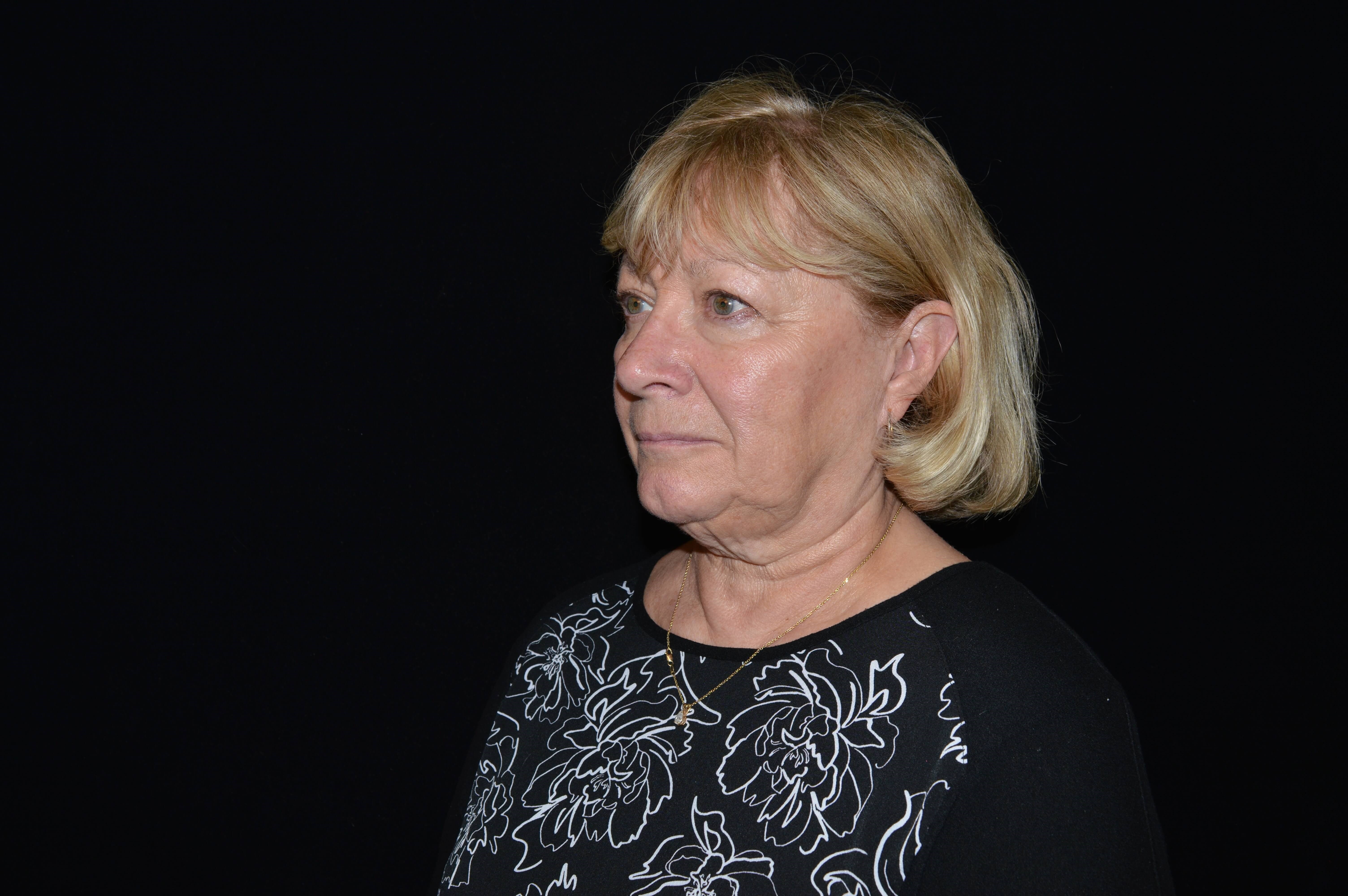 Before and After Before