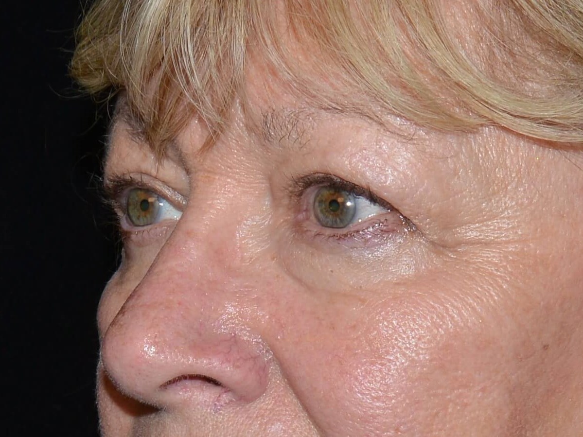 Before and After Before