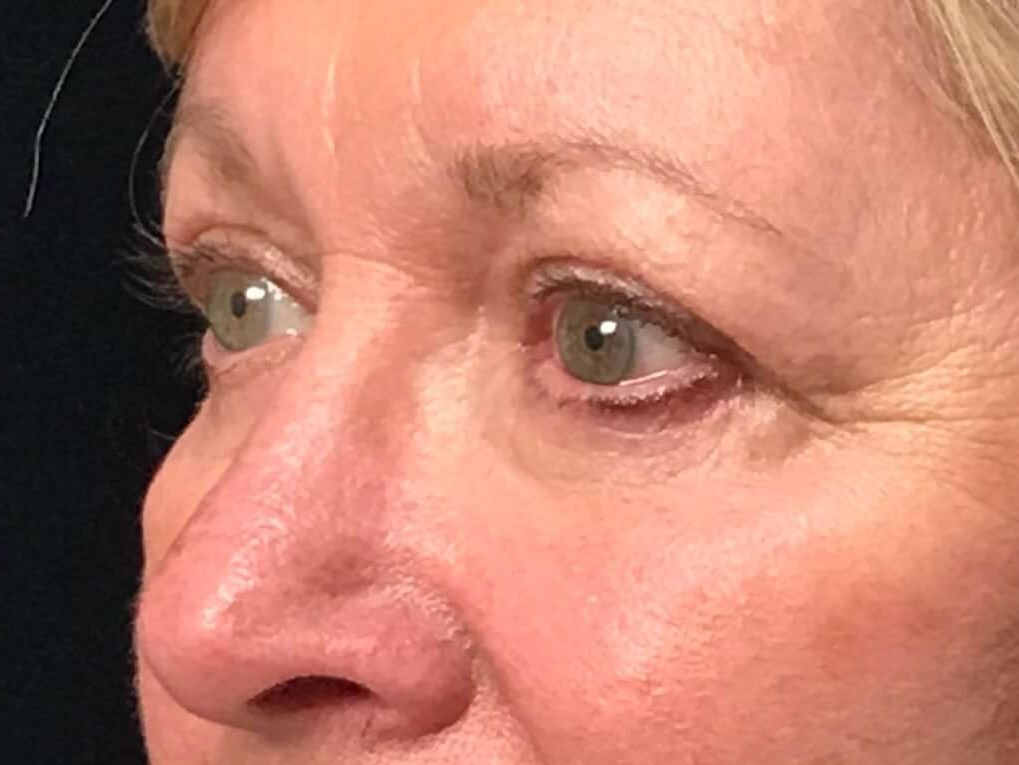 Before and After After