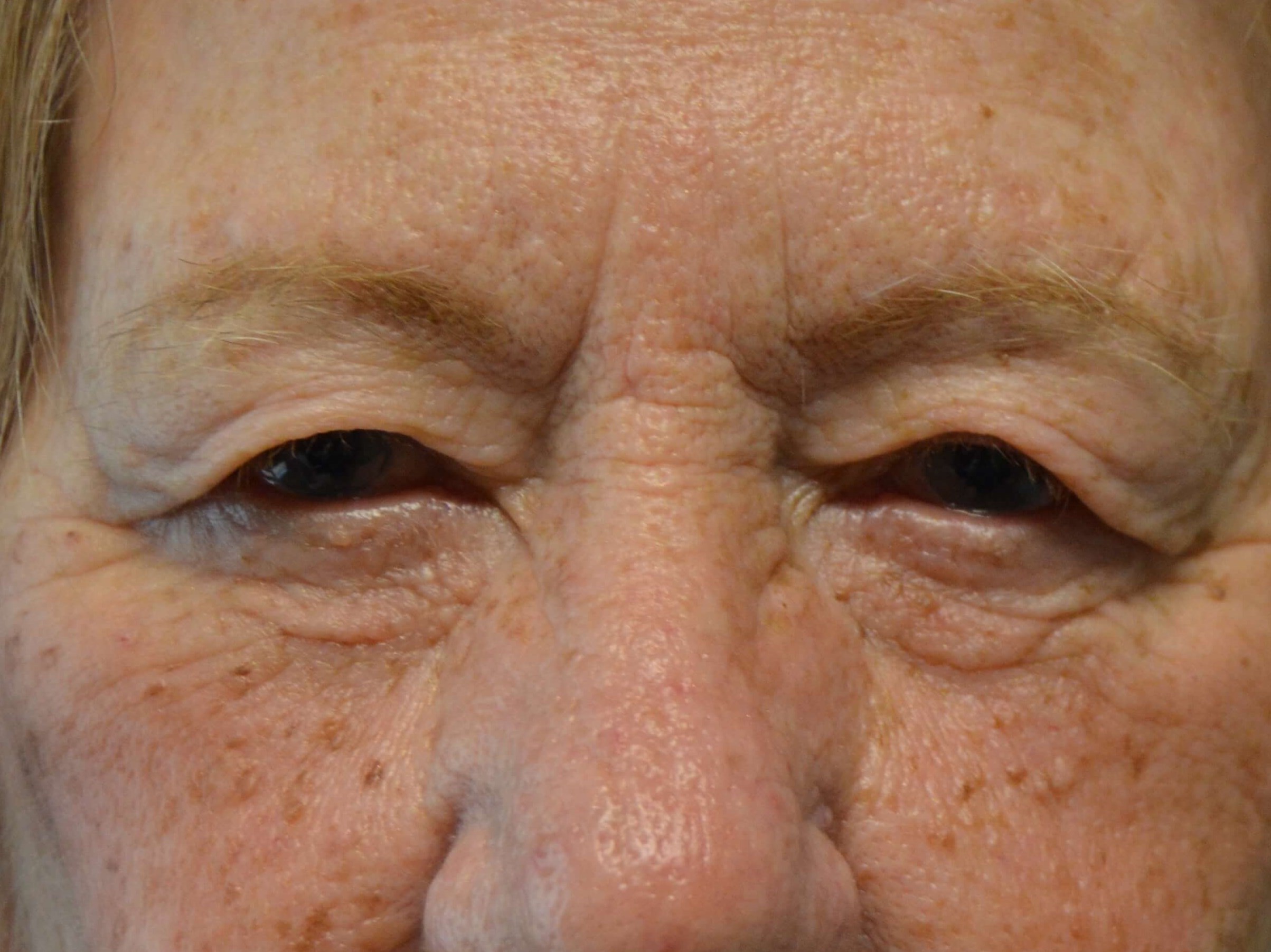 Before and After Before