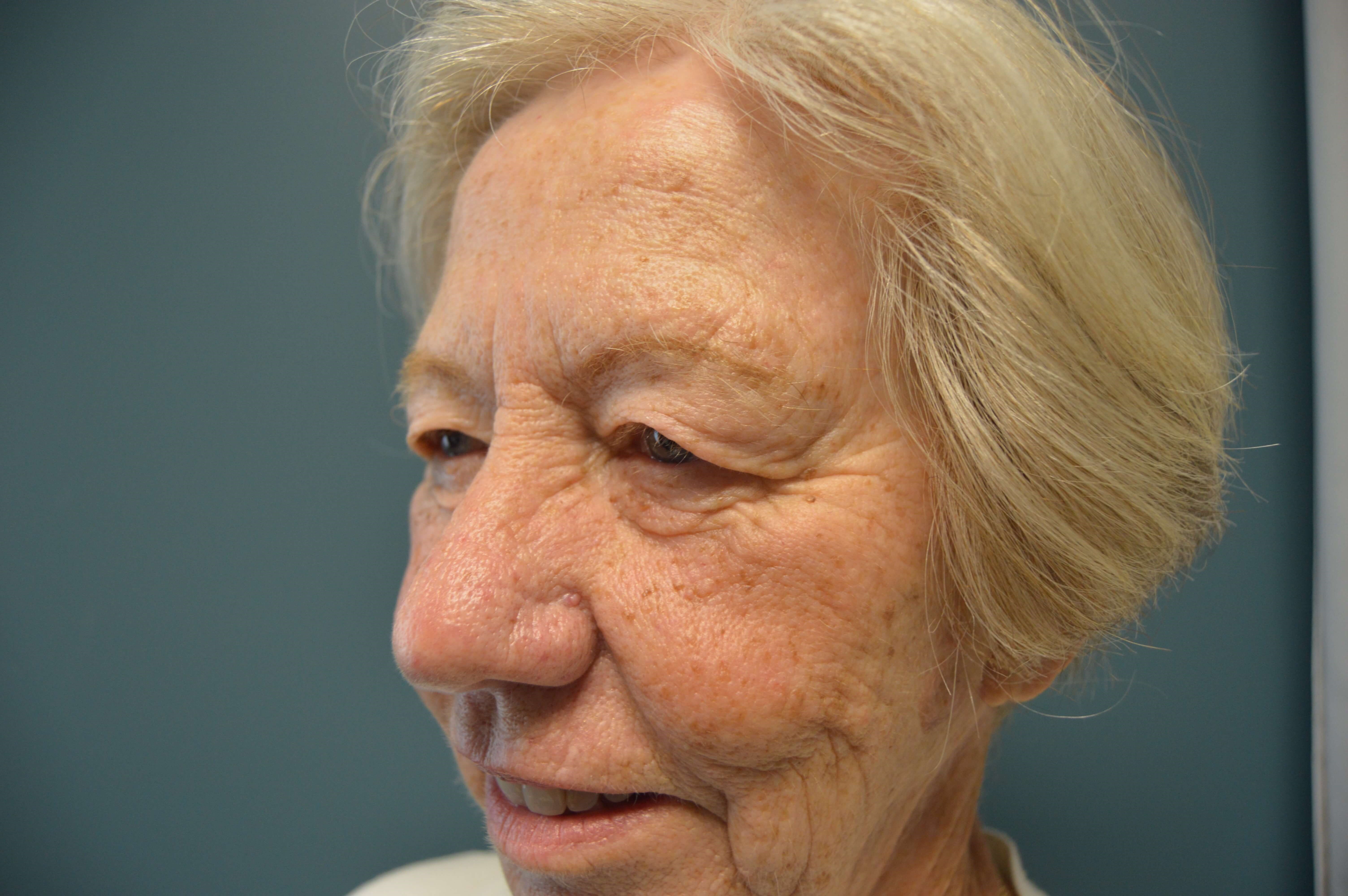 Before and After Before