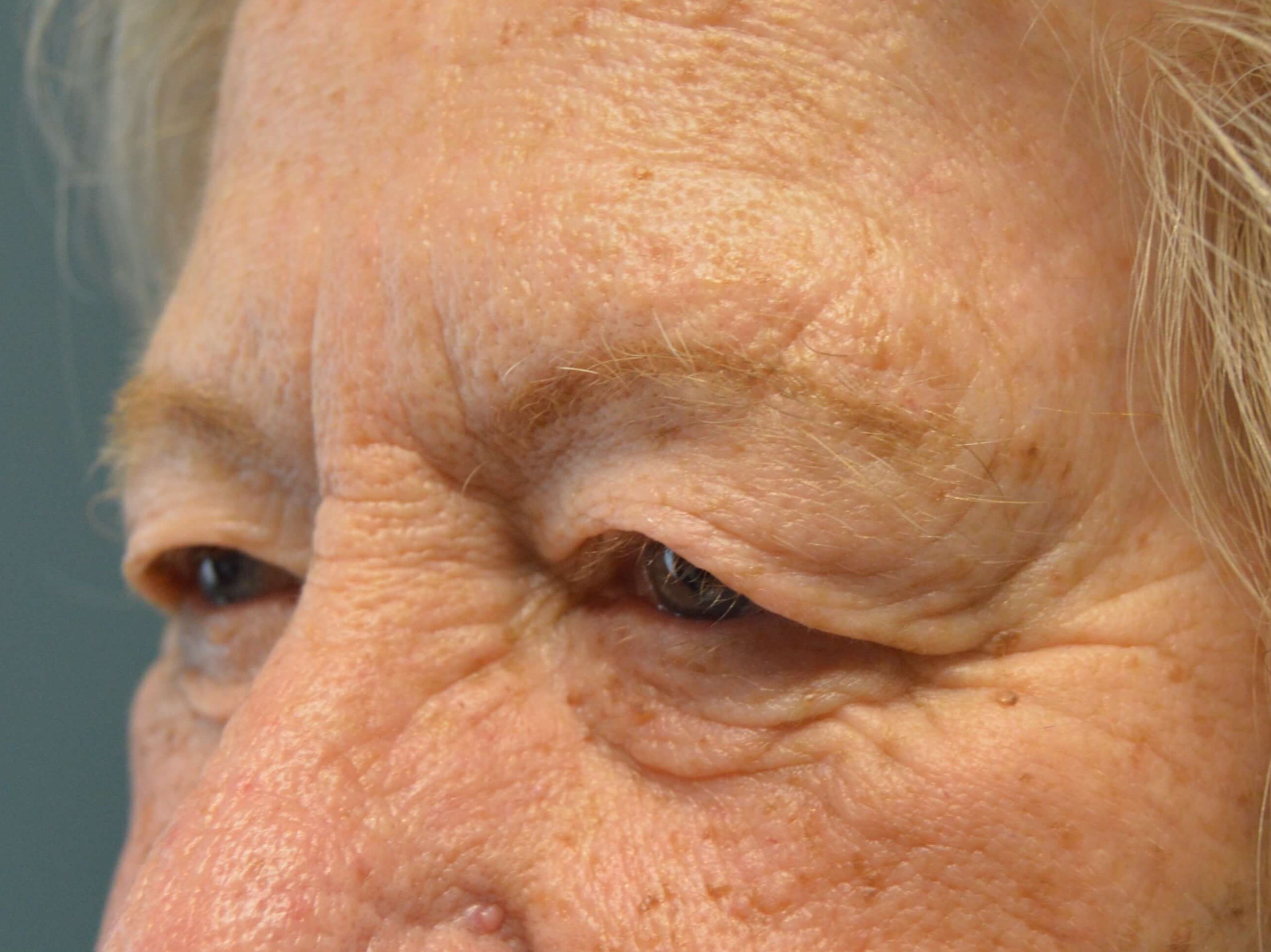 Before and After Before