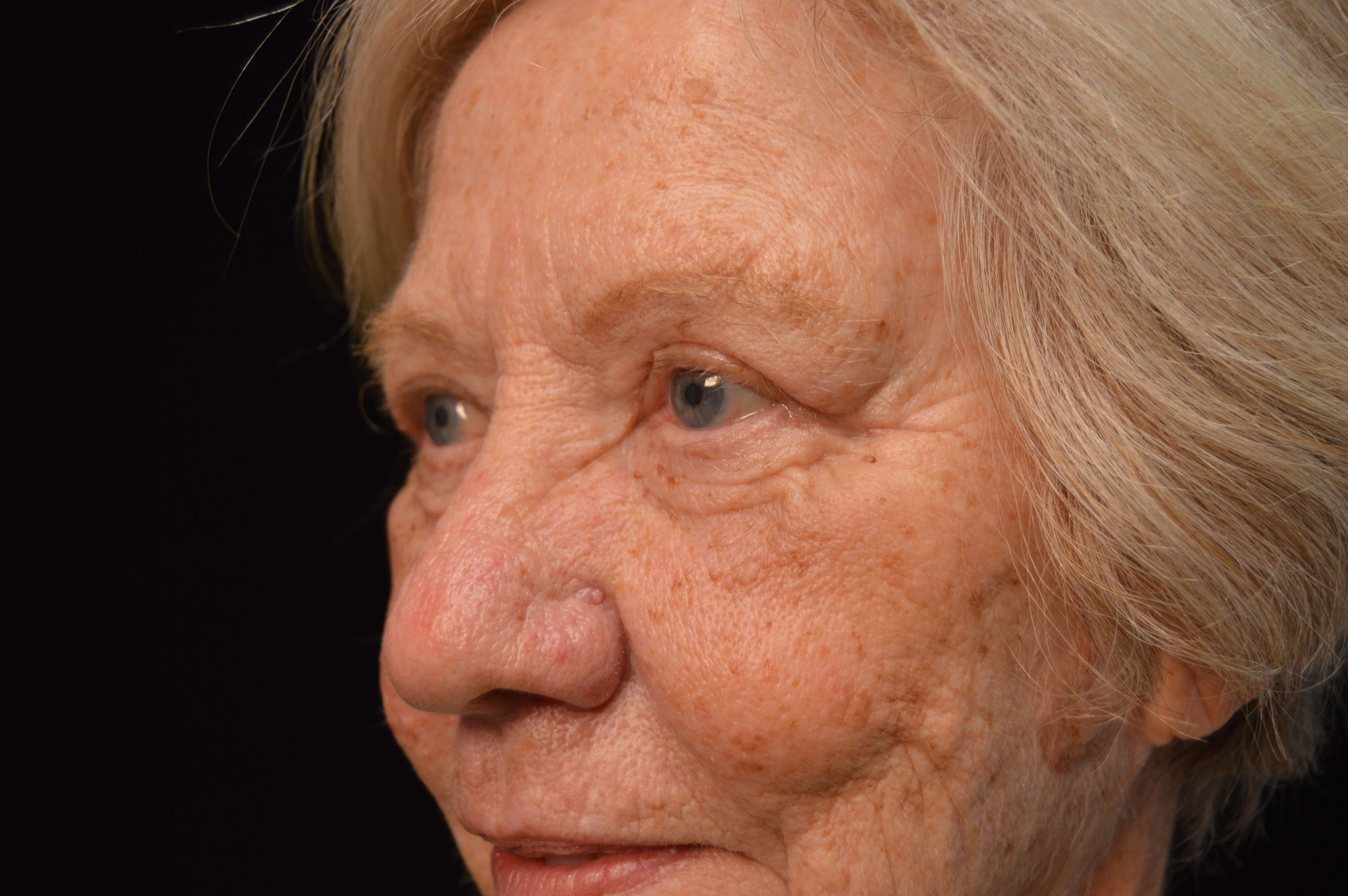 Before and After After