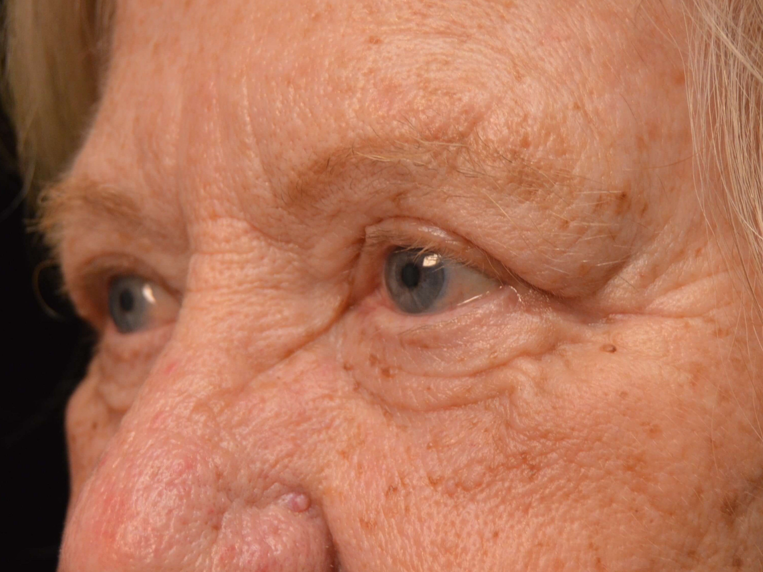 Before and After After