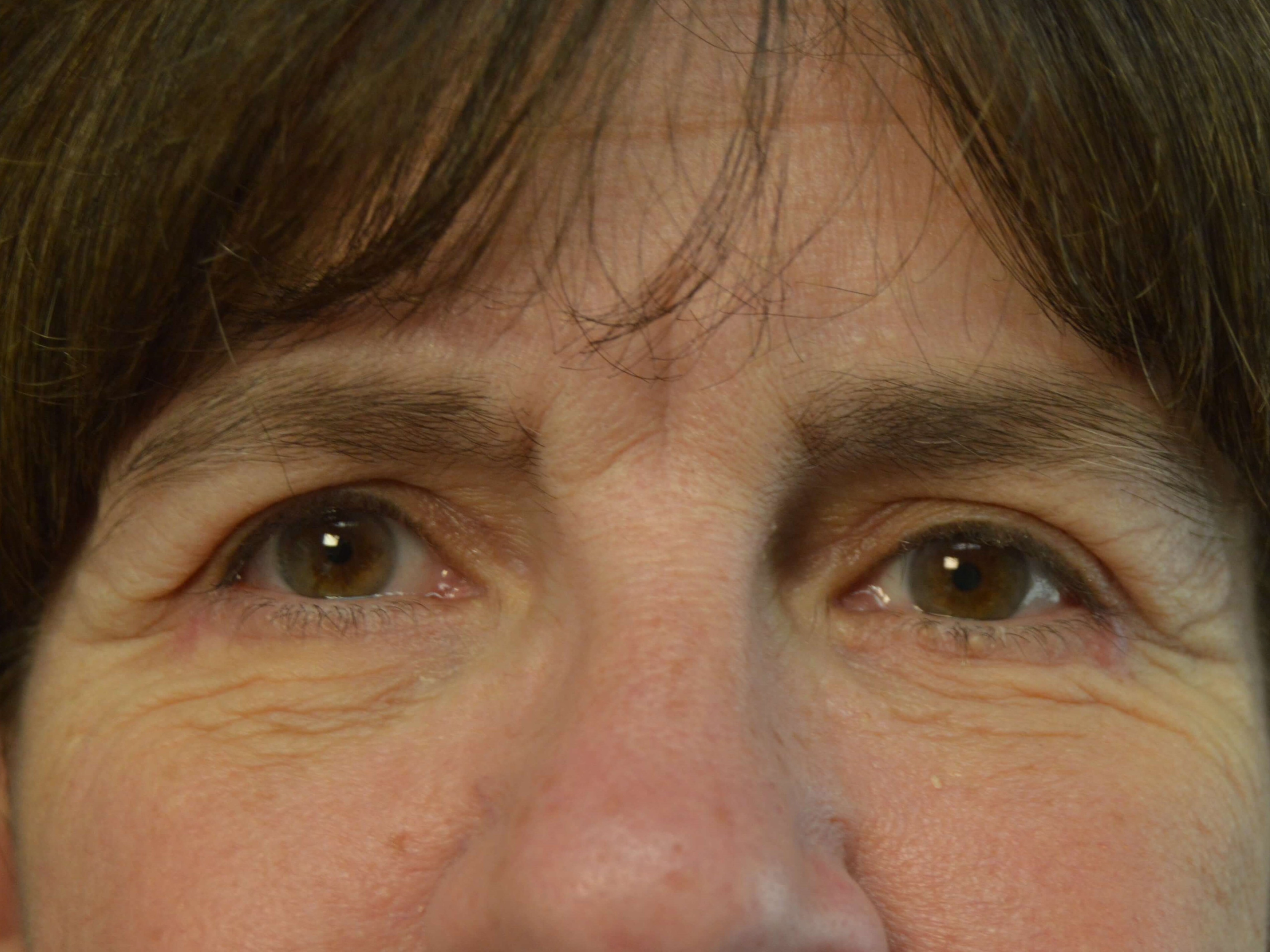 Before and After After