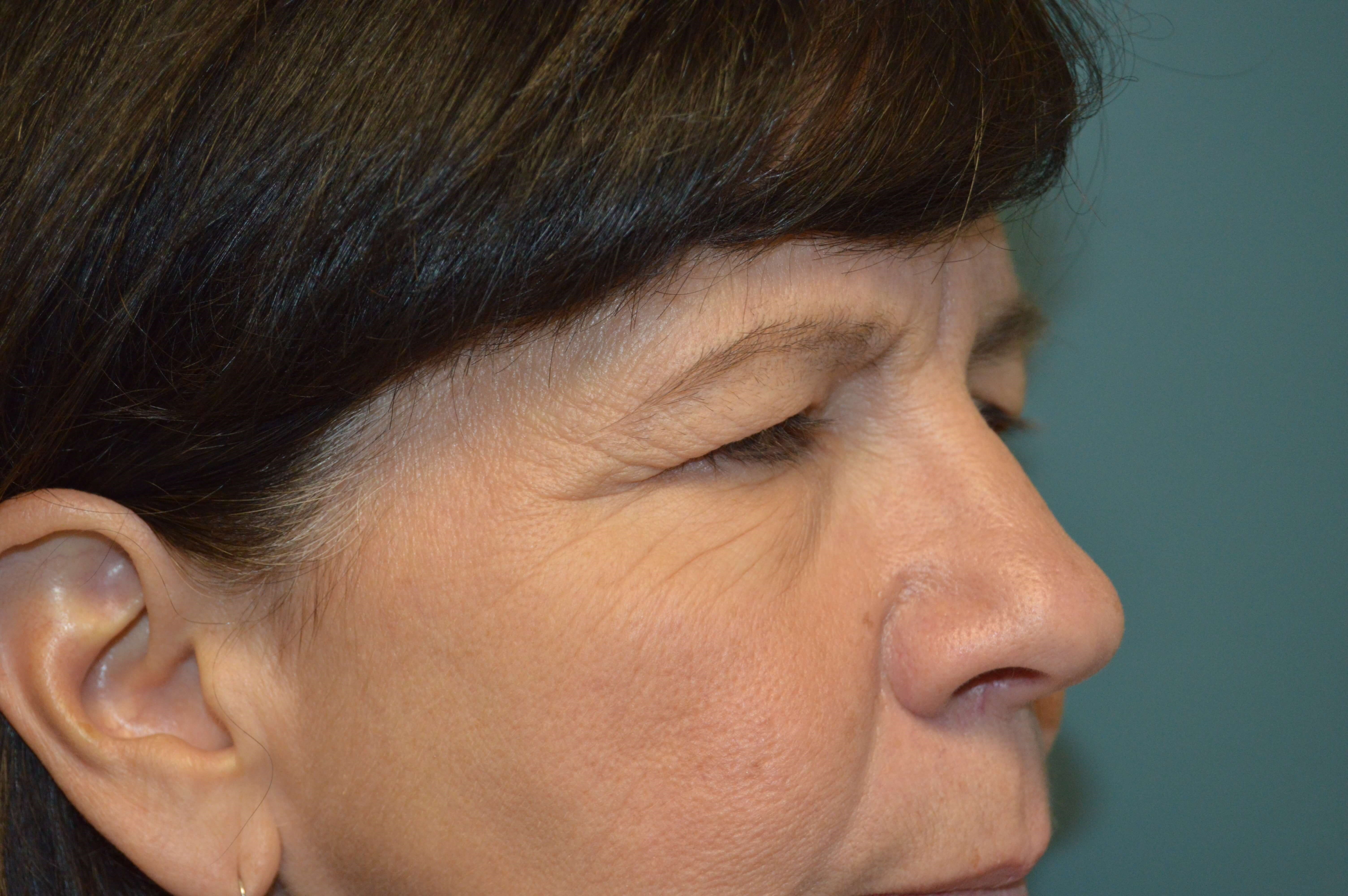 Before and After Before