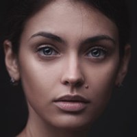 Rhinoplasty